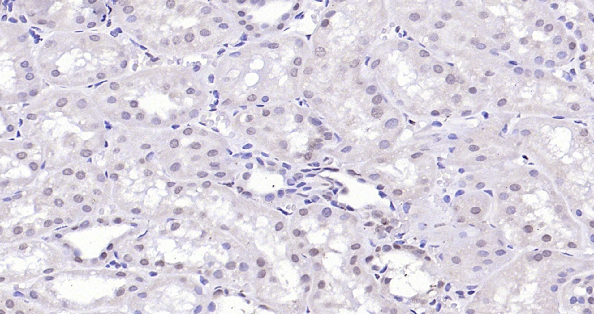 Paraformaldehyde-fixed, paraffin embedded (Human kidney); Antigen retrieval by boiling in sodium citrate buffer (pH6.0) for 15min; Block endogenous peroxidase by 3% hydrogen peroxide for 20 minutes; Blocking buffer (normal goat serum) at 37°C for 30min; Antibody incubation with (KLF2) Polyclonal Antibody, Unconjugated (bs-2772R) at 1:200 overnight at 4°C, followed by operating according to SP Kit(Rabbit) (sp-0023) instructionsand DAB staining.