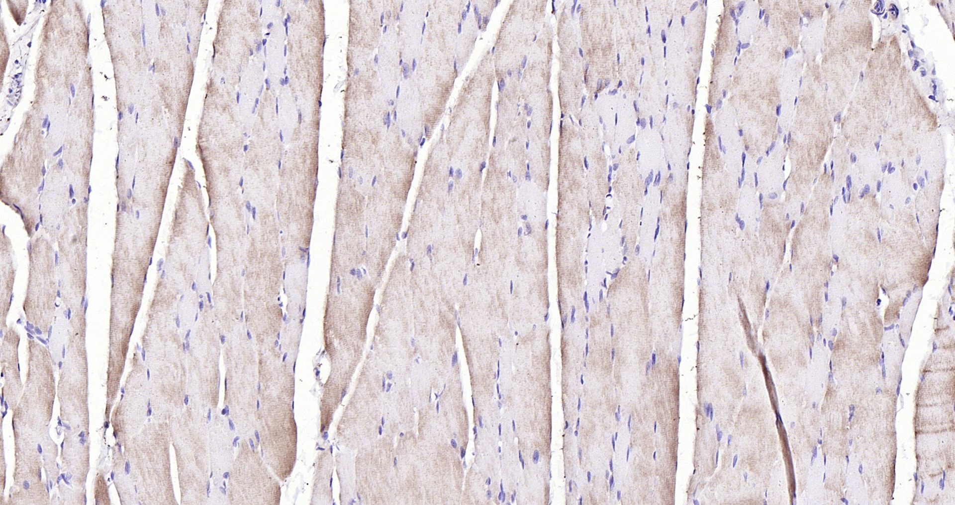 Paraformaldehyde-fixed, paraffin embedded (rat skeletal muscle); Antigen retrieval by boiling in sodium citrate buffer (pH6.0) for 15min; Block endogenous peroxidase by 3% hydrogen peroxide for 20 minutes; Blocking buffer (normal goat serum) at 37°C for 30min; Antibody incubation with (PYGM) Polyclonal Antibody, Unconjugated (bs-5012R) at 1:200 overnight at 4°C, followed by operating according to SP Kit(Rabbit) (sp-0023) instructionsand DAB staining.