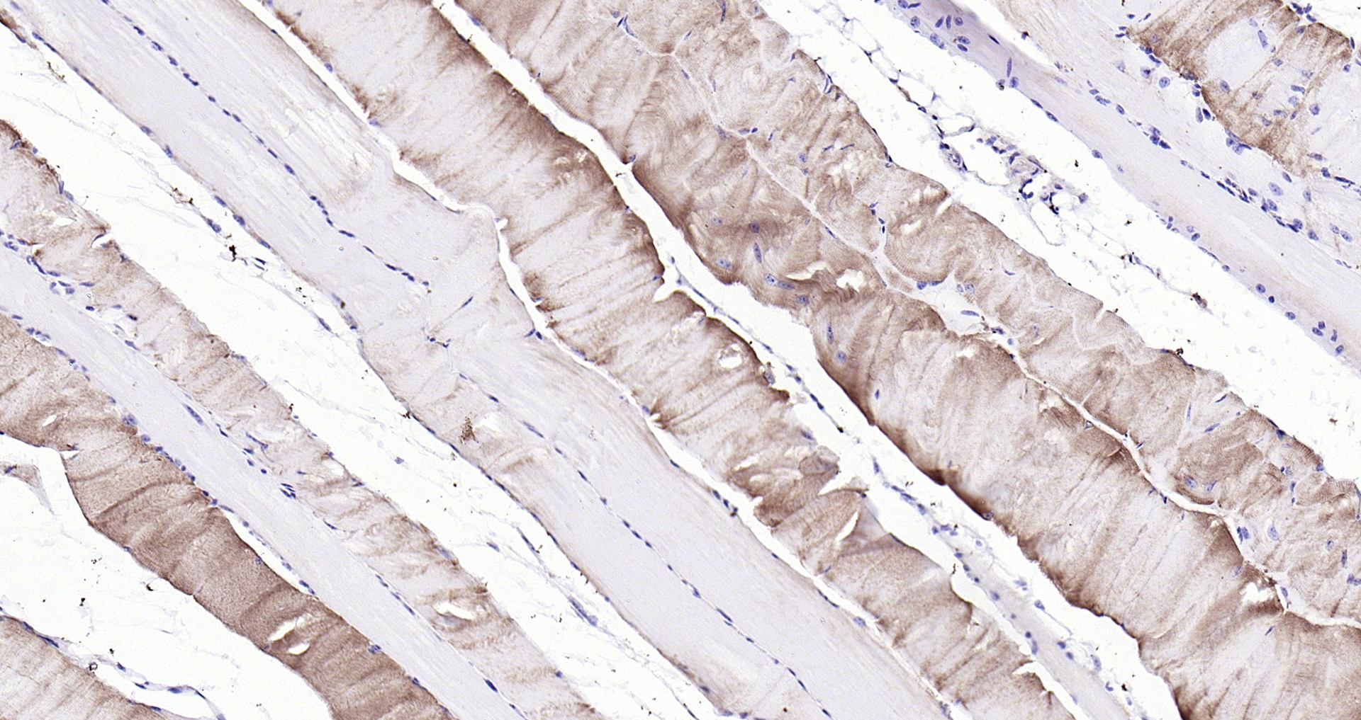 Paraformaldehyde-fixed, paraffin embedded (mouse skeletal muscle); Antigen retrieval by boiling in sodium citrate buffer (pH6.0) for 15min; Block endogenous peroxidase by 3% hydrogen peroxide for 20 minutes; Blocking buffer (normal goat serum) at 37°C for 30min; Antibody incubation with (PYGM) Polyclonal Antibody, Unconjugated (bs-5012R) at 1:200 overnight at 4°C, followed by operating according to SP Kit(Rabbit) (sp-0023) instructionsand DAB staining.