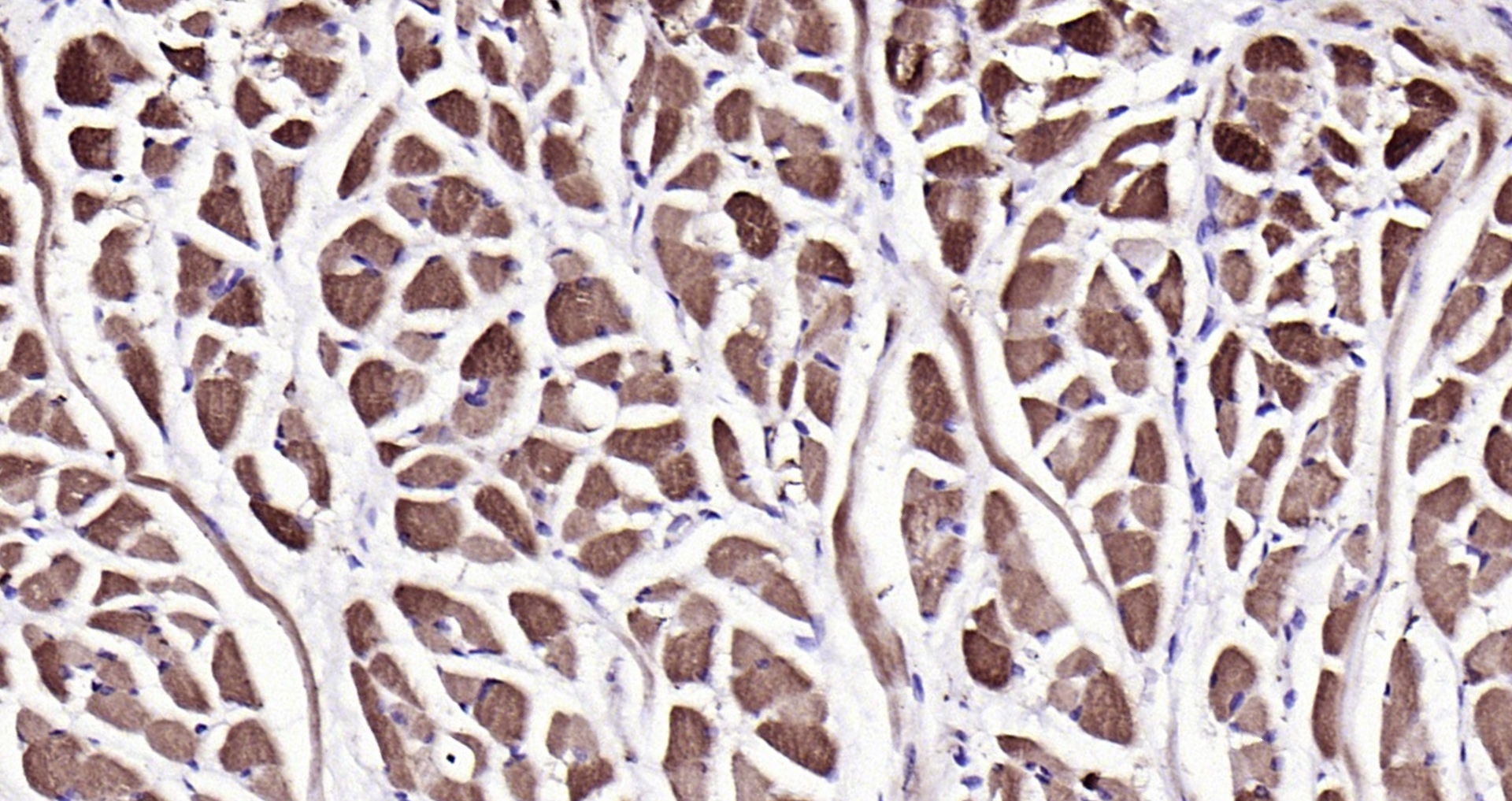Paraformaldehyde-fixed, paraffin embedded (Rat tongue); Antigen retrieval by boiling in sodium citrate buffer (pH6.0) for 15min; Block endogenous peroxidase by 3% hydrogen peroxide for 20 minutes; Blocking buffer (normal goat serum) at 37°C for 30min; Antibody incubation with (PYGM) Polyclonal Antibody, Unconjugated (bs-5012R) at 1:200 overnight at 4°C, followed by operating according to SP Kit(Rabbit) (sp-0023) instructionsand DAB staining.