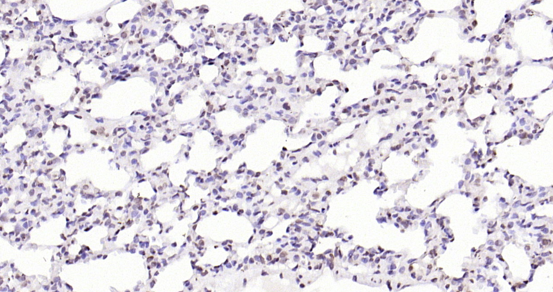 Paraformaldehyde-fixed, paraffin embedded (rat lung); Antigen retrieval by boiling in sodium citrate buffer (pH6.0) for 15min; Block endogenous peroxidase by 3% hydrogen peroxide for 20 minutes; Blocking buffer (normal goat serum) at 37°C for 30min; Antibody incubation with (IL33) Polyclonal Antibody, Unconjugated (bs-2208R) at 1:200 overnight at 4°C, followed by operating according to SP Kit(Rabbit) (sp-0023) instructionsand DAB staining.
