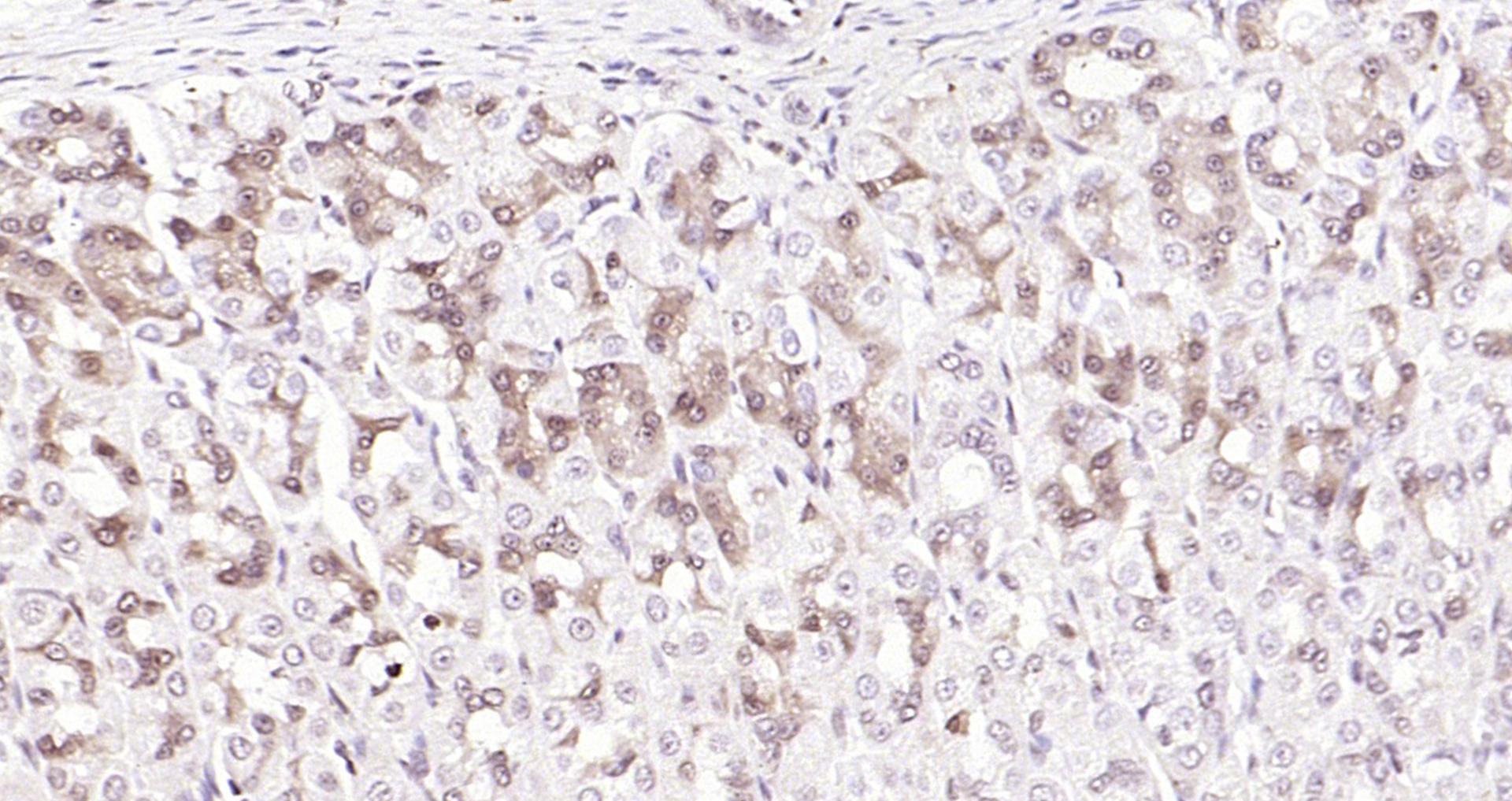 Paraformaldehyde-fixed, paraffin embedded (rat stomach); Antigen retrieval by boiling in sodium citrate buffer (pH6.0) for 15min; Block endogenous peroxidase by 3% hydrogen peroxide for 20 minutes; Blocking buffer (normal goat serum) at 37°C for 30min; Antibody incubation with (IL33) Polyclonal Antibody, Unconjugated (bs-2208R) at 1:200 overnight at 4°C, followed by operating according to SP Kit(Rabbit) (sp-0023) instructionsand DAB staining.