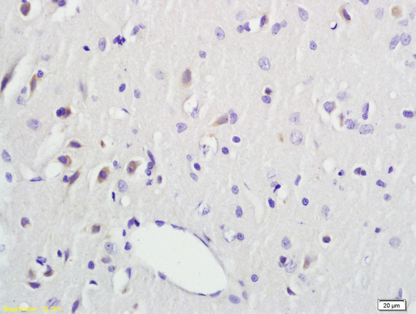 Formalin-fixed and paraffin embedded rat brain labeled with Anti-DTNBP1 Polyclonal Antibody, Unconjugated (bs-1561R) followed by conjugation to the secondary antibody and DAB staining