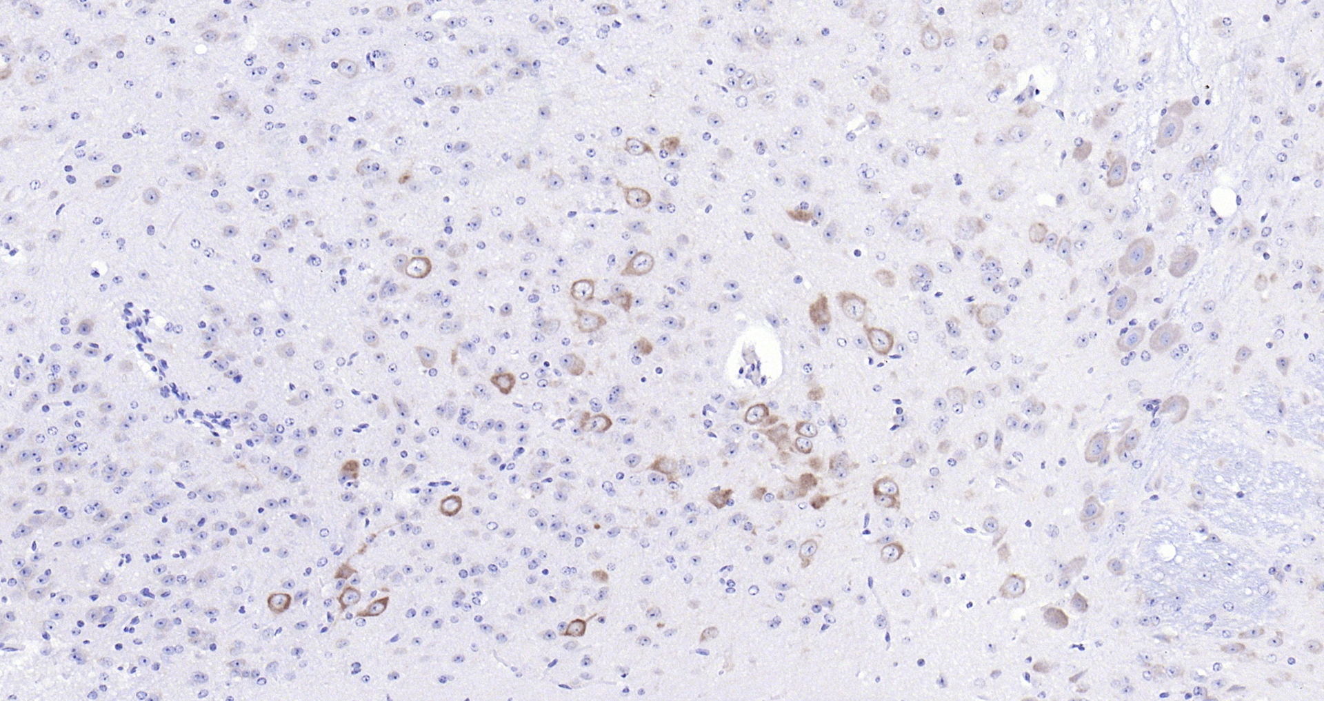 Paraformaldehyde-fixed, paraffin embedded (mouse cerebellum); Antigen retrieval by boiling in sodium citrate buffer (pH6.0) for 15min; Block endogenous peroxidase by 3% hydrogen peroxide for 20 minutes; Blocking buffer (normal goat serum) at 37°C for 30min; Antibody incubation with (SV2C) Polyclonal Antibody, Unconjugated (bs-11366R) at 1:200 overnight at 4°C, followed by operating according to SP Kit(Rabbit) (sp-0023) instructionsand DAB staining.