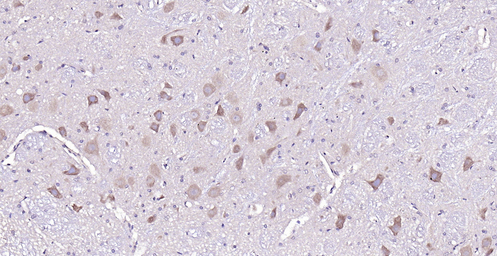 Paraformaldehyde-fixed, paraffin embedded (rat cerebellum); Antigen retrieval by boiling in sodium citrate buffer (pH6.0) for 15min; Block endogenous peroxidase by 3% hydrogen peroxide for 20 minutes; Blocking buffer (normal goat serum) at 37°C for 30min; Antibody incubation with (D4S234E) Polyclonal Antibody, Unconjugated (bs-8204R) at 1:200 overnight at 4°C, followed by operating according to SP Kit(Rabbit) (sp-0023) instructionsand DAB staining.