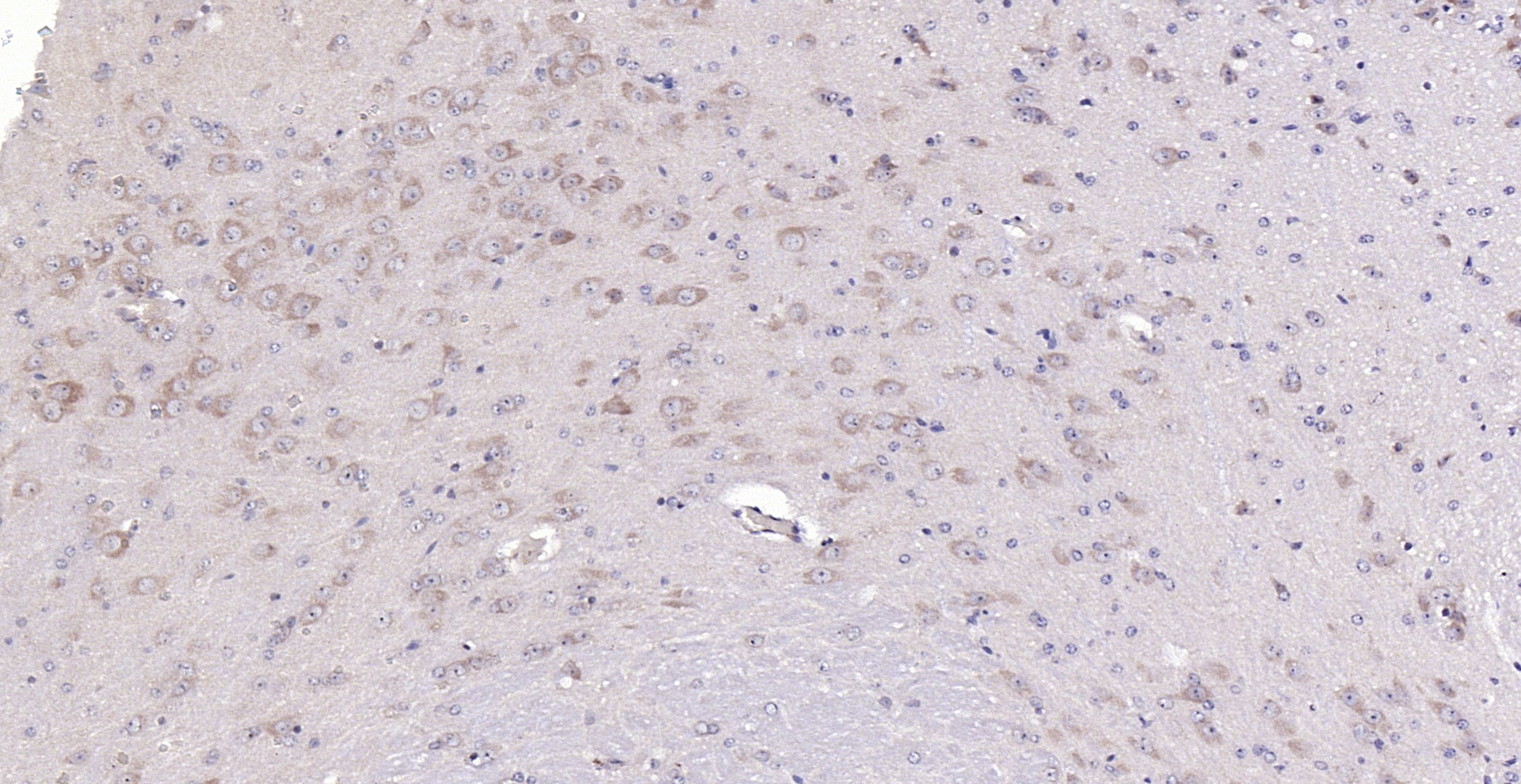 Paraformaldehyde-fixed, paraffin embedded (mouse cerebellum); Antigen retrieval by boiling in sodium citrate buffer (pH6.0) for 15min; Block endogenous peroxidase by 3% hydrogen peroxide for 20 minutes; Blocking buffer (normal goat serum) at 37°C for 30min; Antibody incubation with (D4S234E) Polyclonal Antibody, Unconjugated (bs-8204R) at 1:200 overnight at 4°C, followed by operating according to SP Kit(Rabbit) (sp-0023) instructionsand DAB staining.