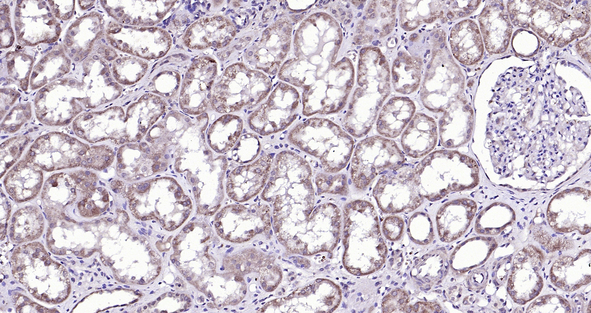 Paraformaldehyde-fixed, paraffin embedded (Human kidney); Antigen retrieval by boiling in sodium citrate buffer (pH6.0) for 15min; Block endogenous peroxidase by 3% hydrogen peroxide for 20 minutes; Blocking buffer (normal goat serum) at 37°C for 30min; Antibody incubation with (TPA) Polyclonal Antibody, Unconjugated (bs-1545R) at 1:200 overnight at 4°C, followed by operating according to SP Kit(Rabbit) (sp-0023) instructionsand DAB staining.