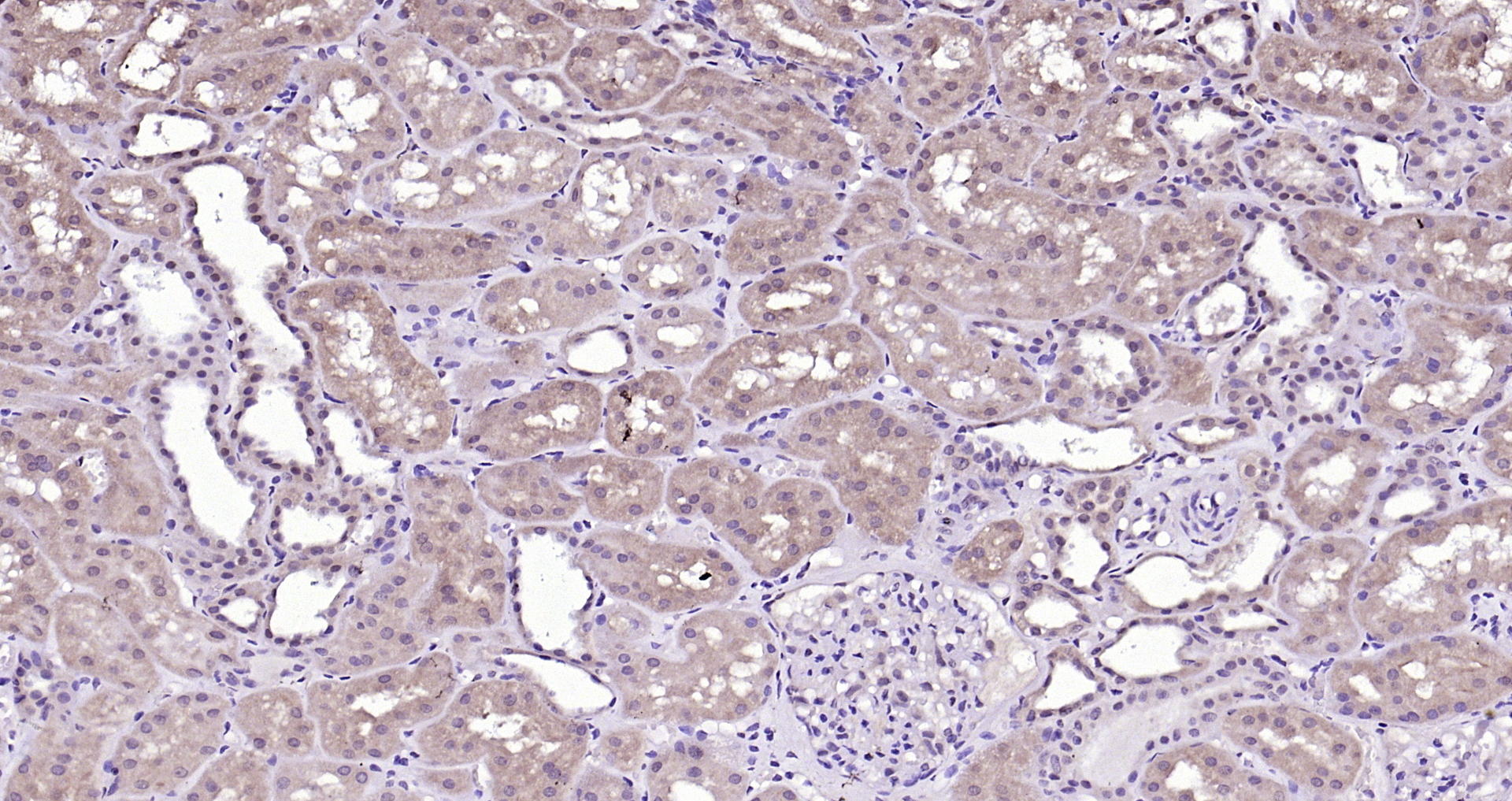 Paraformaldehyde-fixed, paraffin embedded (Human kidney); Antigen retrieval by boiling in sodium citrate buffer (pH6.0) for 15min; Block endogenous peroxidase by 3% hydrogen peroxide for 20 minutes; Blocking buffer (normal goat serum) at 37°C for 30min; Antibody incubation with (Phospho-Tyk2 (Tyr1054 + Tyr1055)) Polyclonal Antibody, Unconjugated (bs-3437R) at 1:200 overnight at 4°C, followed by operating according to SP Kit(Rabbit) (sp-0023) instructionsand DAB staining.