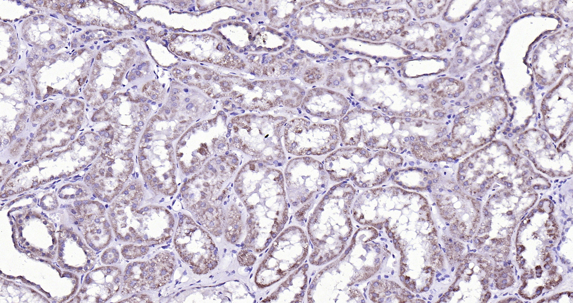 Paraformaldehyde-fixed, paraffin embedded (Human kidney); Antigen retrieval by boiling in sodium citrate buffer (pH6.0) for 15min; Block endogenous peroxidase by 3% hydrogen peroxide for 20 minutes; Blocking buffer (normal goat serum) at 37°C for 30min; Antibody incubation with (RALDH2) Polyclonal Antibody, Unconjugated (bs-3676R) at 1:200 overnight at 4°C, followed by operating according to SP Kit(Rabbit) (sp-0023) instructionsand DAB staining.