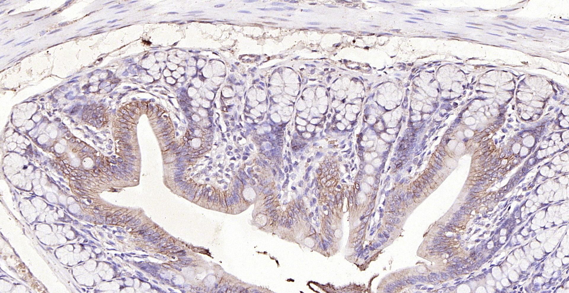 Paraformaldehyde-fixed, paraffin embedded (rat colon); Antigen retrieval by boiling in sodium citrate buffer (pH6.0) for 15min; Block endogenous peroxidase by 3% hydrogen peroxide for 20 minutes; Blocking buffer (normal goat serum) at 37°C for 30min; Antibody incubation with (LI Cadherin) Polyclonal Antibody, Unconjugated (bs-1617R) at 1:200 overnight at 4°C, followed by operating according to SP Kit(Rabbit) (sp-0023) instructionsand DAB staining.