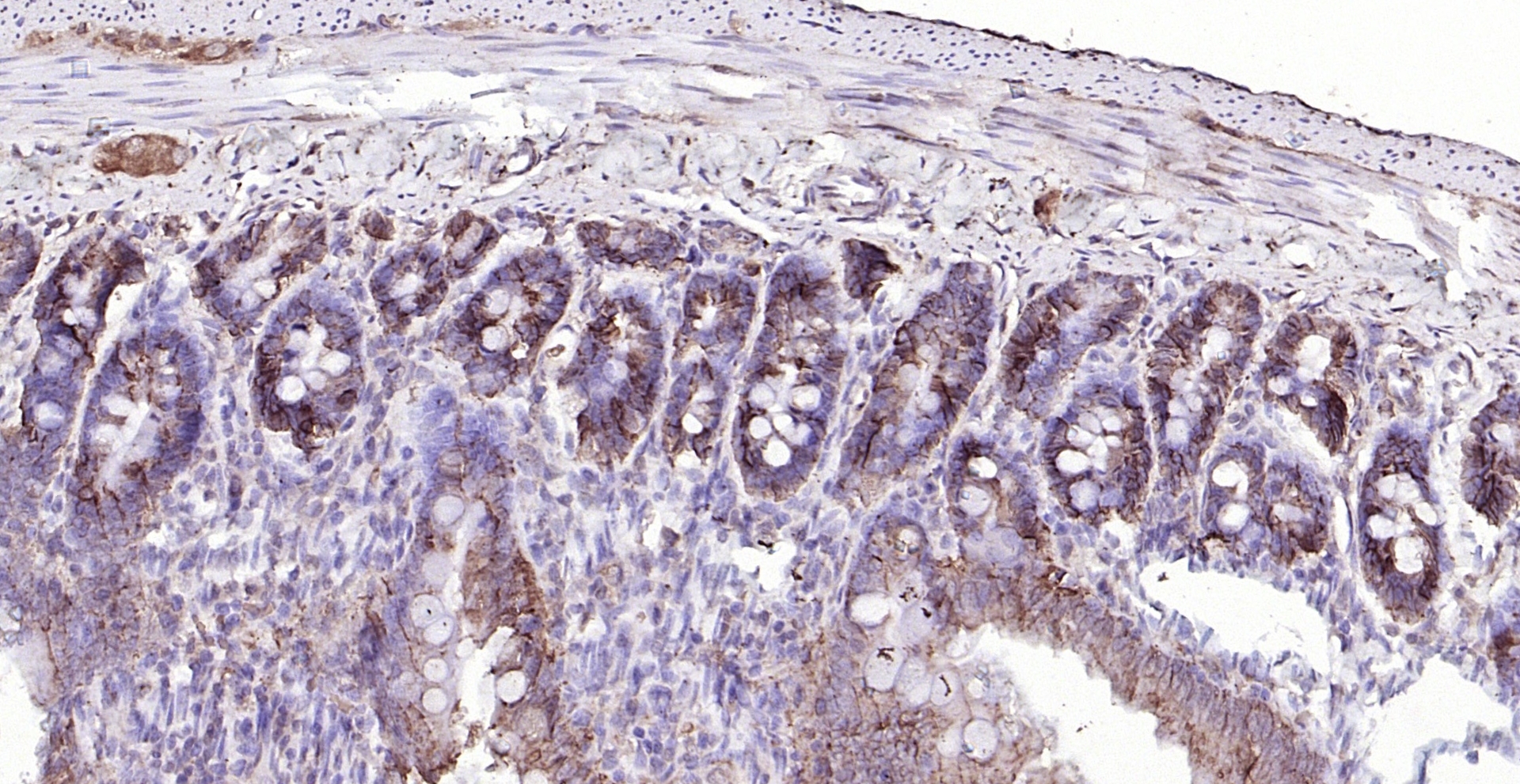 Paraformaldehyde-fixed, paraffin embedded (rat small intestine); Antigen retrieval by boiling in sodium citrate buffer (pH6.0) for 15min; Block endogenous peroxidase by 3% hydrogen peroxide for 20 minutes; Blocking buffer (normal goat serum) at 37°C for 30min; Antibody incubation with (LI Cadherin) Polyclonal Antibody, Unconjugated (bs-1617R) at 1:200 overnight at 4°C, followed by operating according to SP Kit(Rabbit) (sp-0023) instructionsand DAB staining.