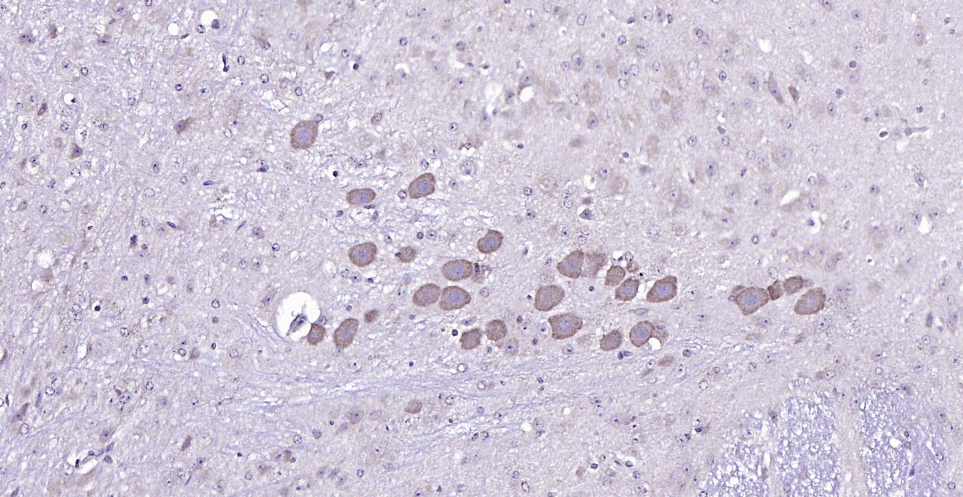 Paraformaldehyde-fixed, paraffin embedded (mouse cerebellum); Antigen retrieval by boiling in sodium citrate buffer (pH6.0) for 15min; Block endogenous peroxidase by 3% hydrogen peroxide for 20 minutes; Blocking buffer (normal goat serum) at 37°C for 30min; Antibody incubation with (NELL1) Polyclonal Antibody, Unconjugated (bs-10704R) at 1:200 overnight at 4°C, followed by operating according to SP Kit(Rabbit) (sp-0023) instructionsand DAB staining.