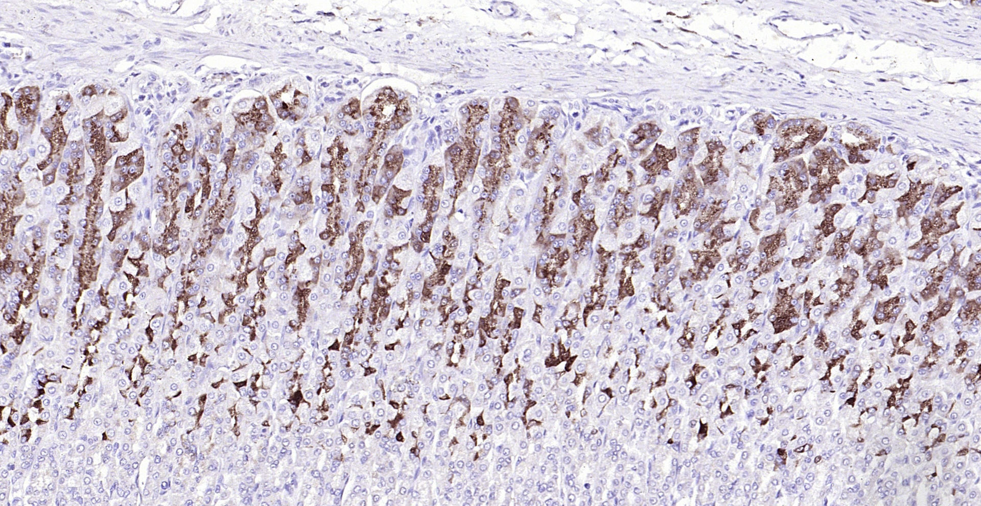 Paraformaldehyde-fixed, paraffin embedded (rat stomach); Antigen retrieval by boiling in sodium citrate buffer (pH6.0) for 15min; Block endogenous peroxidase by 3% hydrogen peroxide for 20 minutes; Blocking buffer (normal goat serum) at 37°C for 30min; Antibody incubation with (MBOAT4) Polyclonal Antibody, Unconjugated (bs-13355R) at 1:200 overnight at 4°C, followed by operating according to SP Kit(Rabbit) (sp-0023) instructionsand DAB staining.