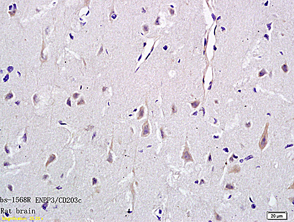 Formalin-fixed and paraffin embedded rat brain tissue labeled with Anti-CD203c Polyclonal Antibody, Unconjugated (bs-1568R) followed by conjugation to the secondary antibody and DAB staining