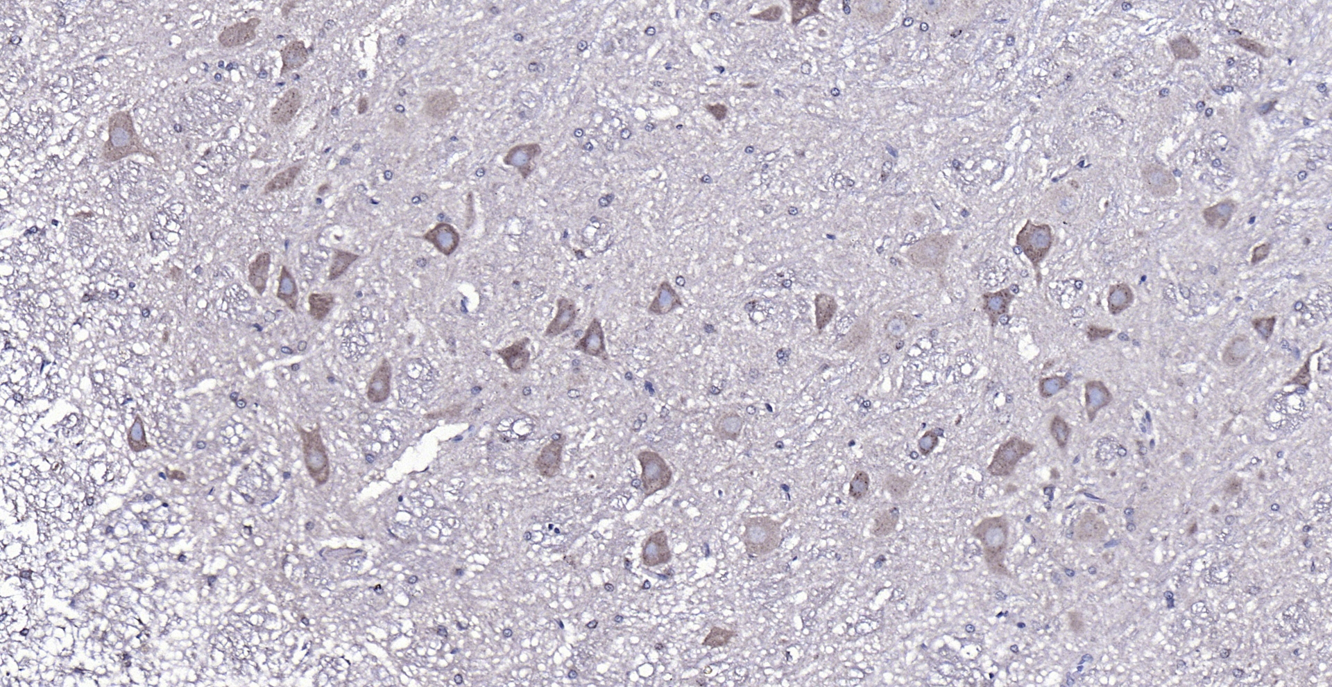 Paraformaldehyde-fixed, paraffin embedded (rat Cerebellum ); Antigen retrieval by boiling in sodium citrate buffer (pH6.0) for 15min; Block endogenous peroxidase by 3% hydrogen peroxide for 20 minutes; Blocking buffer (normal goat serum) at 37°C for 30min; Antibody incubation with (NF-M ) Polyclonal Antibody, Unconjugated (bs-0710R) at 1:200 overnight at 4°C, followed by operating according to SP Kit(Rabbit) (sp-0023) instructionsand DAB staining.