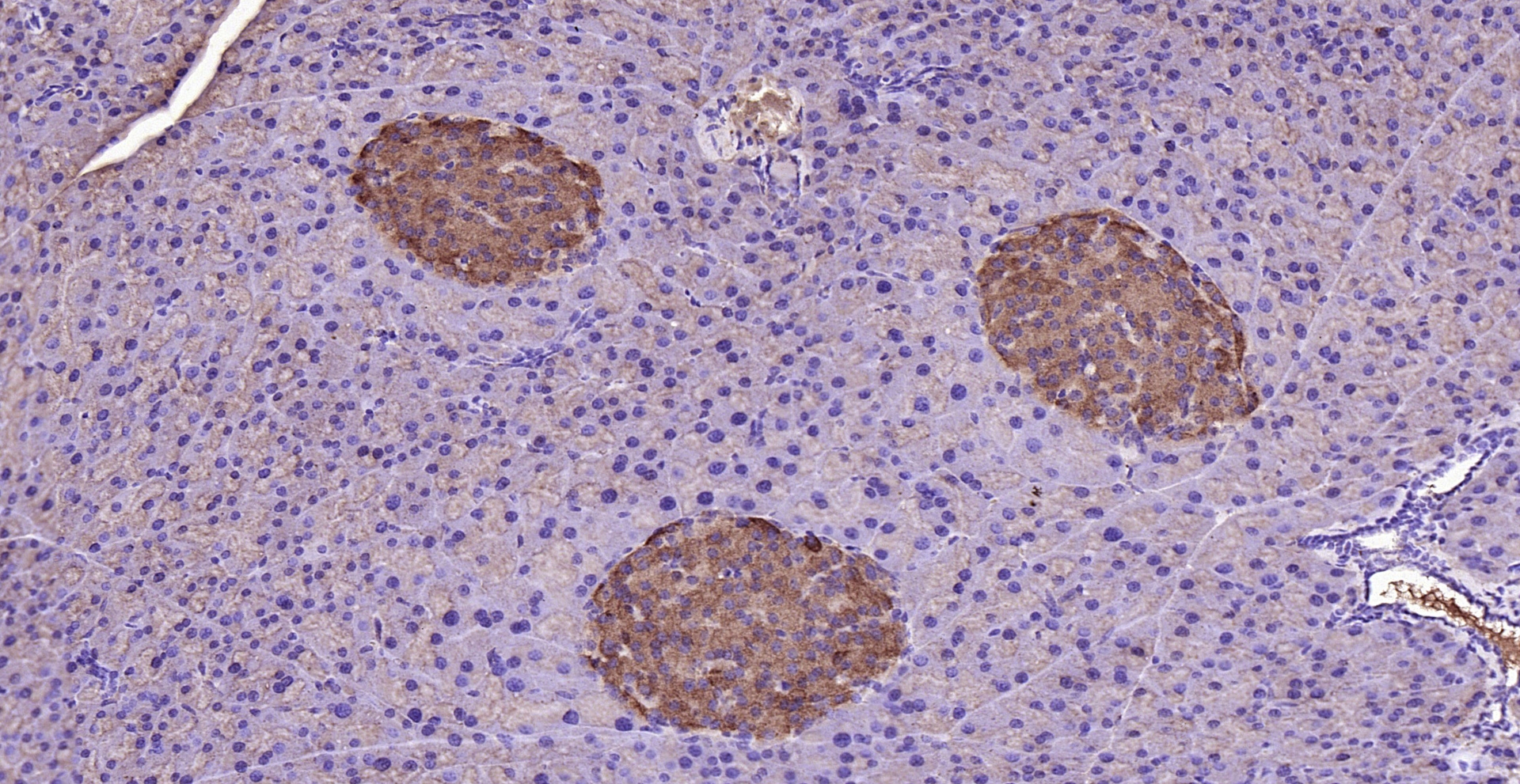 Paraformaldehyde-fixed, paraffin embedded (rat pancreas); Antigen retrieval by boiling in sodium citrate buffer (pH6.0) for 15min; Block endogenous peroxidase by 3% hydrogen peroxide for 20 minutes; Blocking buffer (normal goat serum) at 37°C for 30min; Antibody incubation with (Visfatin) Polyclonal Antibody, Unconjugated (bs-0272R) at 1:200 overnight at 4°C, followed by operating according to SP Kit(Rabbit) (sp-0023) instructionsand DAB staining.