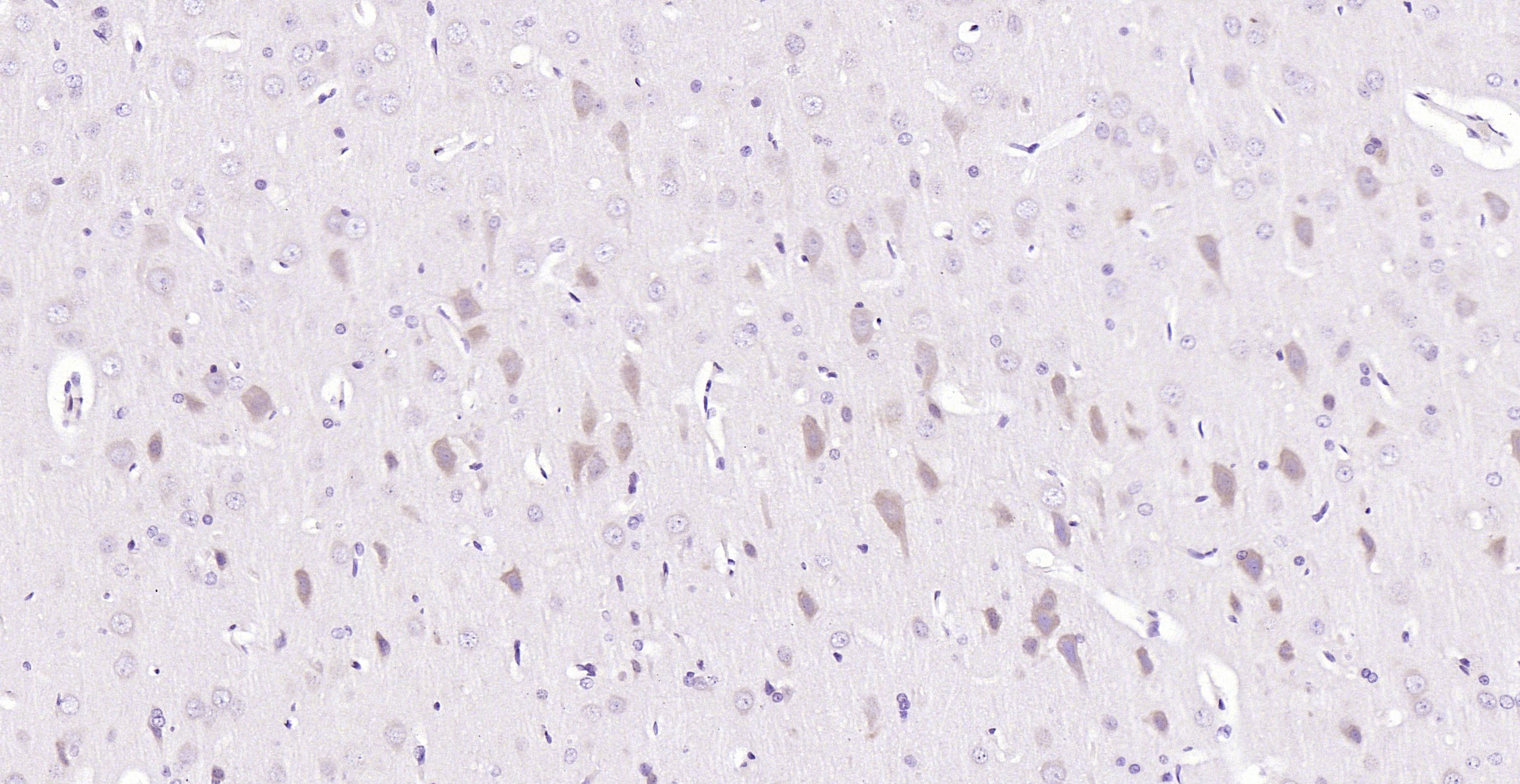 Paraformaldehyde-fixed, paraffin embedded (rat brain); Antigen retrieval by boiling in sodium citrate buffer (pH6.0) for 15min; Block endogenous peroxidase by 3% hydrogen peroxide for 20 minutes; Blocking buffer (normal goat serum) at 37°C for 30min; Antibody incubation with (Glutathione Reductase) Polyclonal Antibody, Unconjugated (bs-0837R) at 1:200 overnight at 4°C, followed by operating according to SP Kit(Rabbit) (sp-0023) instructionsand DAB staining. Paraformaldehyde-fixed, paraffin embedded (rat brain); Antigen retrieval by boiling in sodium citrate buffer (pH6.0) for 15min; Block endogenous peroxidase by 3% hydrogen peroxide for 20 minutes; Blocking buffer (normal goat serum) at 37°C for 30min; Antibody incubation with (Glutathione Reductase) Polyclonal Antibody, Unconjugated (bs-0837R) at 1:200 overnight at 4°C, followed by operating according to SP Kit(Rabbit) (sp-0023) instructionsand DAB staining.