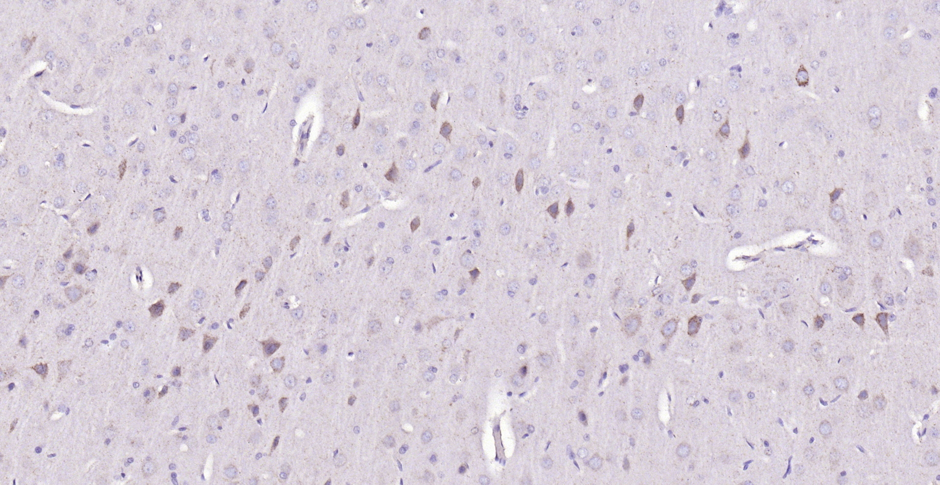 Paraformaldehyde-fixed, paraffin embedded (rat brain); Antigen retrieval by boiling in sodium citrate buffer (pH6.0) for 15min; Block endogenous peroxidase by 3% hydrogen peroxide for 20 minutes; Blocking buffer (normal goat serum) at 37°C for 30min; Antibody incubation with (BMAL1) Polyclonal Antibody, Unconjugated (bs-3750R) at 1:200 overnight at 4°C, followed by operating according to SP Kit(Rabbit) (sp-0023) instructionsand DAB staining.