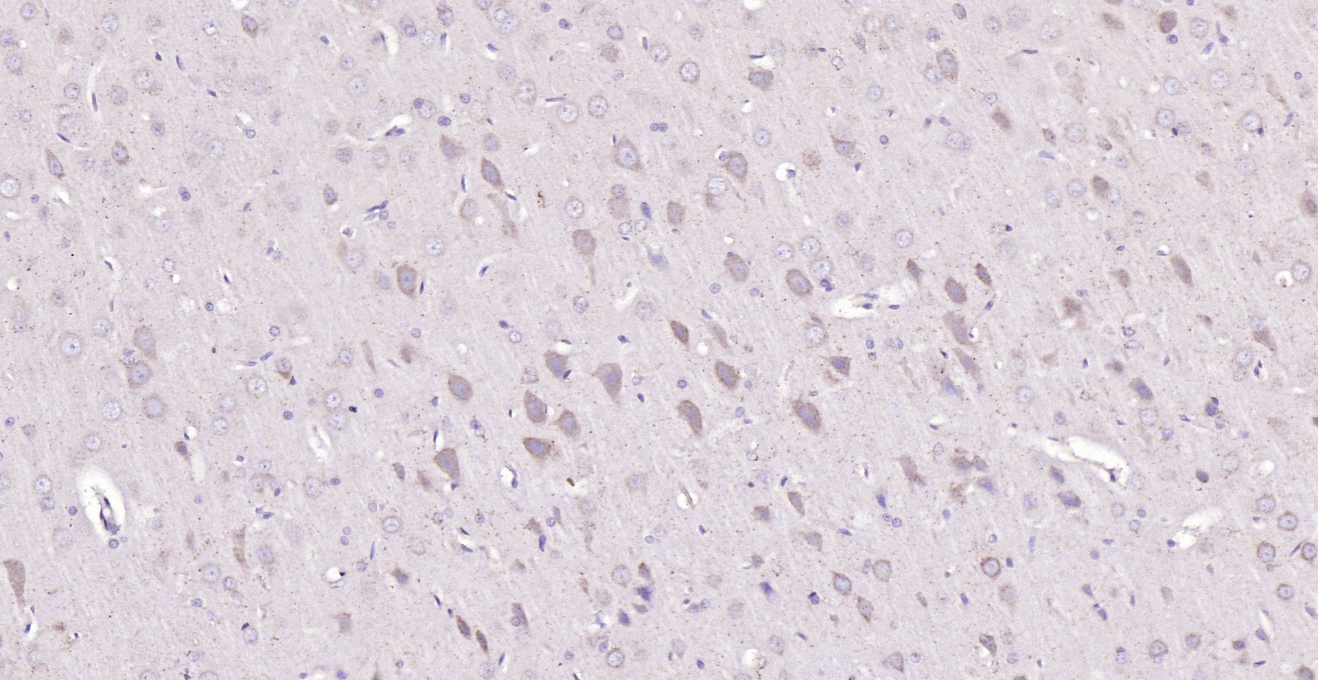 Paraformaldehyde-fixed, paraffin embedded (rat brain); Antigen retrieval by boiling in sodium citrate buffer (pH6.0) for 15min; Block endogenous peroxidase by 3% hydrogen peroxide for 20 minutes; Blocking buffer (normal goat serum) at 37°C for 30min; Antibody incubation with (BMAL1) Polyclonal Antibody, Unconjugated (bs-3750R) at 1:200 overnight at 4°C, followed by operating according to SP Kit(Rabbit) (sp-0023) instructionsand DAB staining.