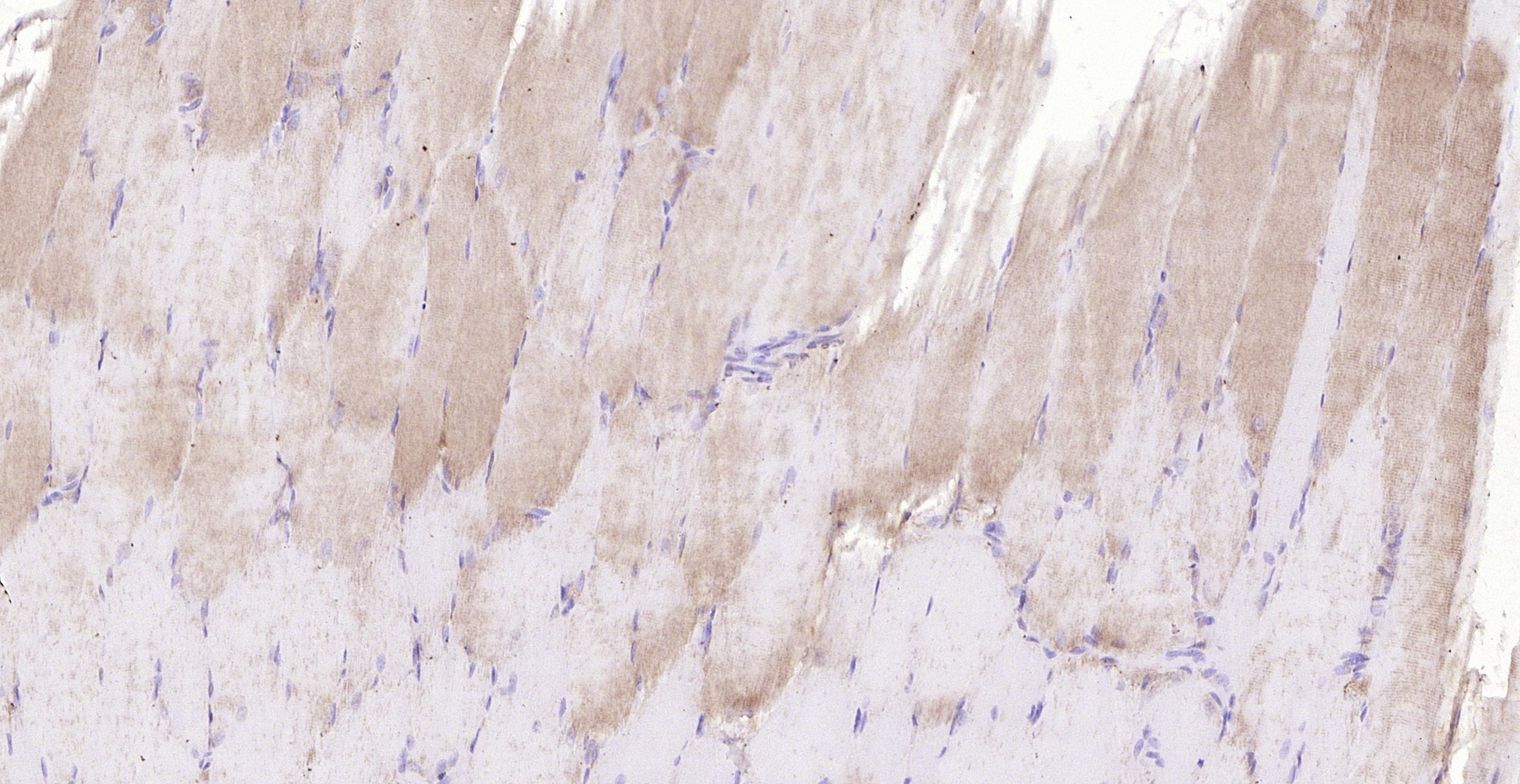 Paraformaldehyde-fixed, paraffin embedded (rat skeletal muscle); Antigen retrieval by boiling in sodium citrate buffer (pH6.0) for 15min; Block endogenous peroxidase by 3% hydrogen peroxide for 20 minutes; Blocking buffer (normal goat serum) at 37°C for 30min; Antibody incubation with (Tenomodulin) Polyclonal Antibody, Unconjugated (bs-7525R) at 1:200 overnight at 4°C, followed by operating according to SP Kit(Rabbit) (sp-0023) instructionsand DAB staining. Paraformaldehyde-fixed, paraffin embedded (rat skeletal muscle); Antigen retrieval by boiling in sodium citrate buffer (pH6.0) for 15min; Block endogenous peroxidase by 3% hydrogen peroxide for 20 minutes; Blocking buffer (normal goat serum) at 37°C for 30min; Antibody incubation with (Tenomodulin) Polyclonal Antibody, Unconjugated (bs-7525R) at 1:200 overnight at 4°C, followed by operating according to SP Kit(Rabbit) (sp-0023) instructionsand DAB staining.
