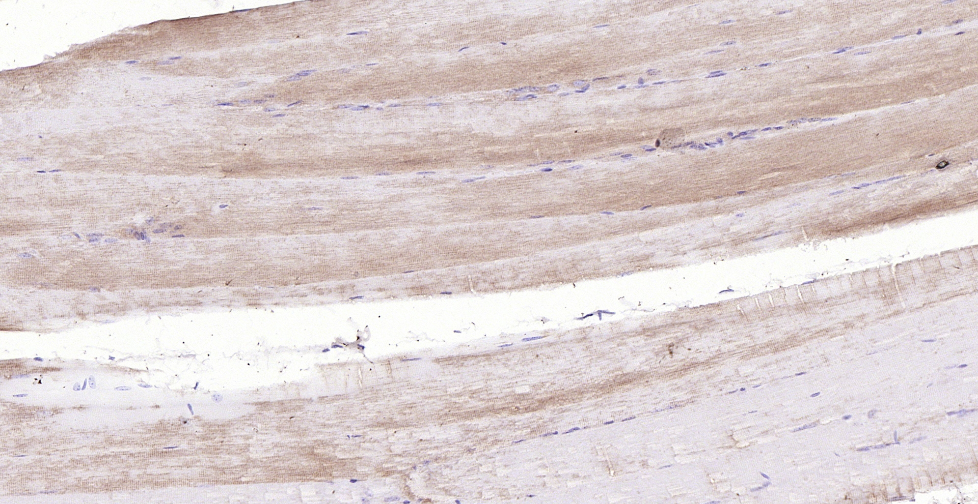 Paraformaldehyde-fixed, paraffin embedded (mouse skeletal muscle); Antigen retrieval by boiling in sodium citrate buffer (pH6.0) for 15min; Block endogenous peroxidase by 3% hydrogen peroxide for 20 minutes; Blocking buffer (normal goat serum) at 37°C for 30min; Antibody incubation with (Tenomodulin) Polyclonal Antibody, Unconjugated (bs-7525R) at 1:200 overnight at 4°C, followed by operating according to SP Kit(Rabbit) (sp-0023) instructionsand DAB staining. Paraformaldehyde-fixed, paraffin embedded (mouse skeletal muscle); Antigen retrieval by boiling in sodium citrate buffer (pH6.0) for 15min; Block endogenous peroxidase by 3% hydrogen peroxide for 20 minutes; Blocking buffer (normal goat serum) at 37°C for 30min; Antibody incubation with (Tenomodulin) Polyclonal Antibody, Unconjugated (bs-7525R) at 1:200 overnight at 4°C, followed by operating according to SP Kit(Rabbit) (sp-0023) instructionsand DAB staining.