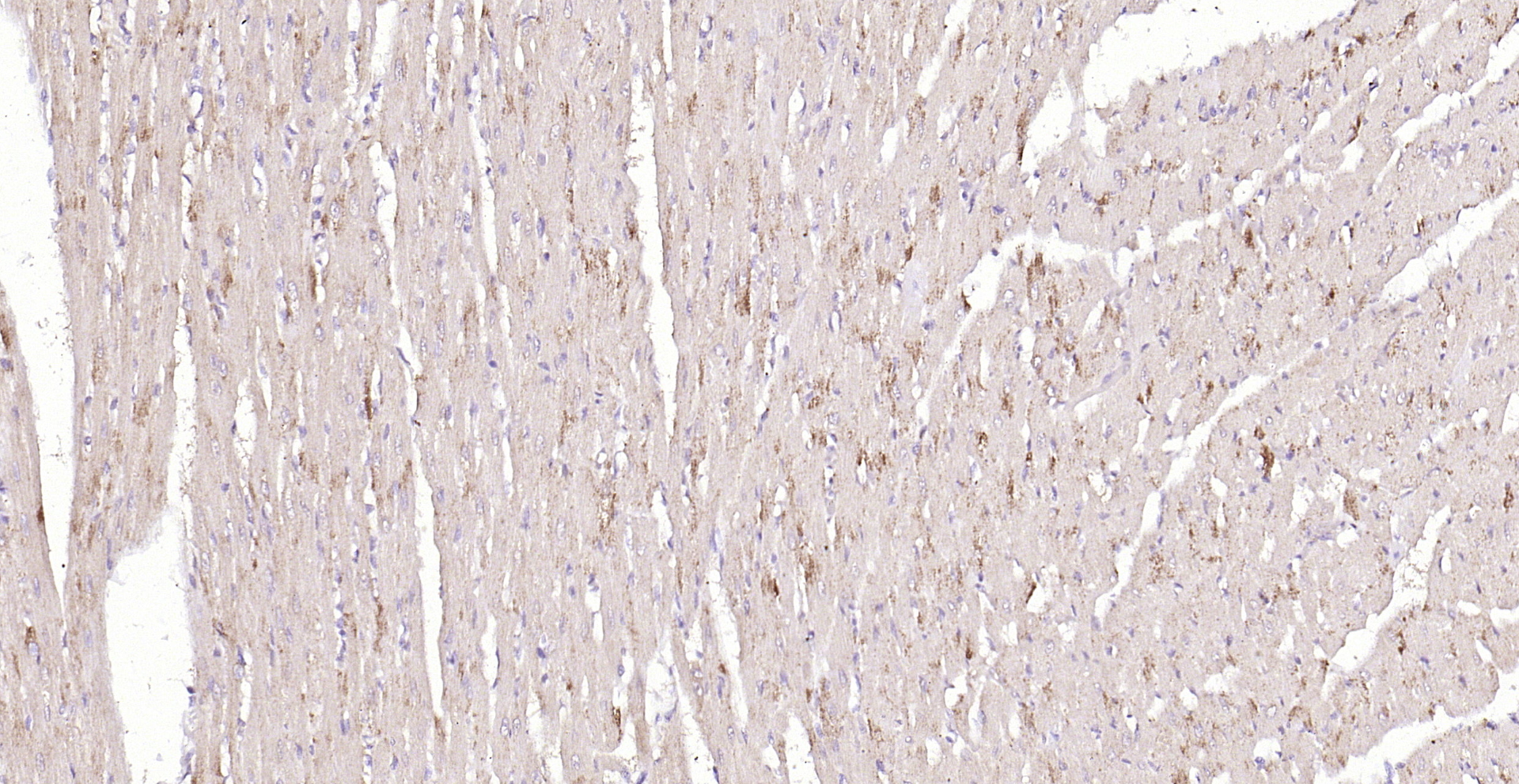 Paraformaldehyde-fixed, paraffin embedded (rat heart); Antigen retrieval by boiling in sodium citrate buffer (pH6.0) for 15min; Block endogenous peroxidase by 3% hydrogen peroxide for 20 minutes; Blocking buffer (normal goat serum) at 37°C for 30min; Antibody incubation with (Tenomodulin) Polyclonal Antibody, Unconjugated (bs-7525R) at 1:200 overnight at 4°C, followed by operating according to SP Kit(Rabbit) (sp-0023) instructionsand DAB staining. Paraformaldehyde-fixed, paraffin embedded (rat heart); Antigen retrieval by boiling in sodium citrate buffer (pH6.0) for 15min; Block endogenous peroxidase by 3% hydrogen peroxide for 20 minutes; Blocking buffer (normal goat serum) at 37°C for 30min; Antibody incubation with (Tenomodulin) Polyclonal Antibody, Unconjugated (bs-7525R) at 1:200 overnight at 4°C, followed by operating according to SP Kit(Rabbit) (sp-0023) instructionsand DAB staining.