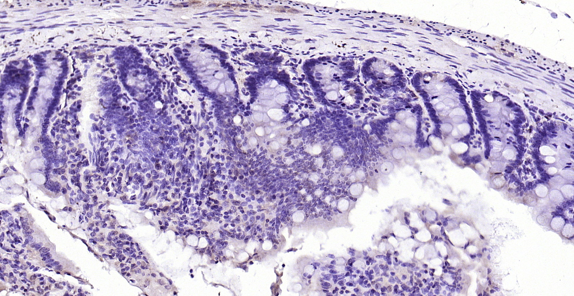 Paraformaldehyde-fixed, paraffin embedded (rat small intestine); Antigen retrieval by boiling in sodium citrate buffer (pH6.0) for 15min; Block endogenous peroxidase by 3% hydrogen peroxide for 20 minutes; Blocking buffer (normal goat serum) at 37°C for 30min; Antibody incubation with (DFFB) Polyclonal Antibody, Unconjugated (bs-0043R) at 1:200 overnight at 4°C, followed by operating according to SP Kit(Rabbit) (sp-0023) instructionsand DAB staining.
