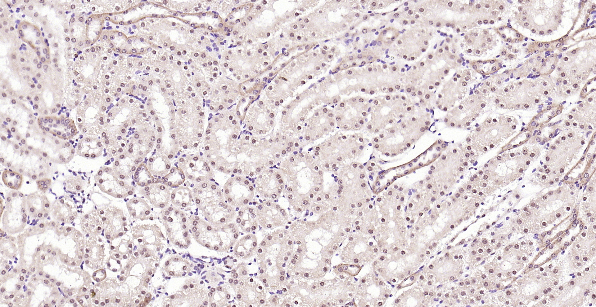 Paraformaldehyde-fixed, paraffin embedded (mouse kidney); Antigen retrieval by boiling in sodium citrate buffer (pH6.0) for 15min; Block endogenous peroxidase by 3% hydrogen peroxide for 20 minutes; Blocking buffer (normal goat serum) at 37°C for 30min; Antibody incubation with (Thioredoxin) Polyclonal Antibody, Unconjugated (bs-0458R) at 1:200 overnight at 4°C, followed by operating according to SP Kit(Rabbit) (sp-0023) instructionsand DAB staining.