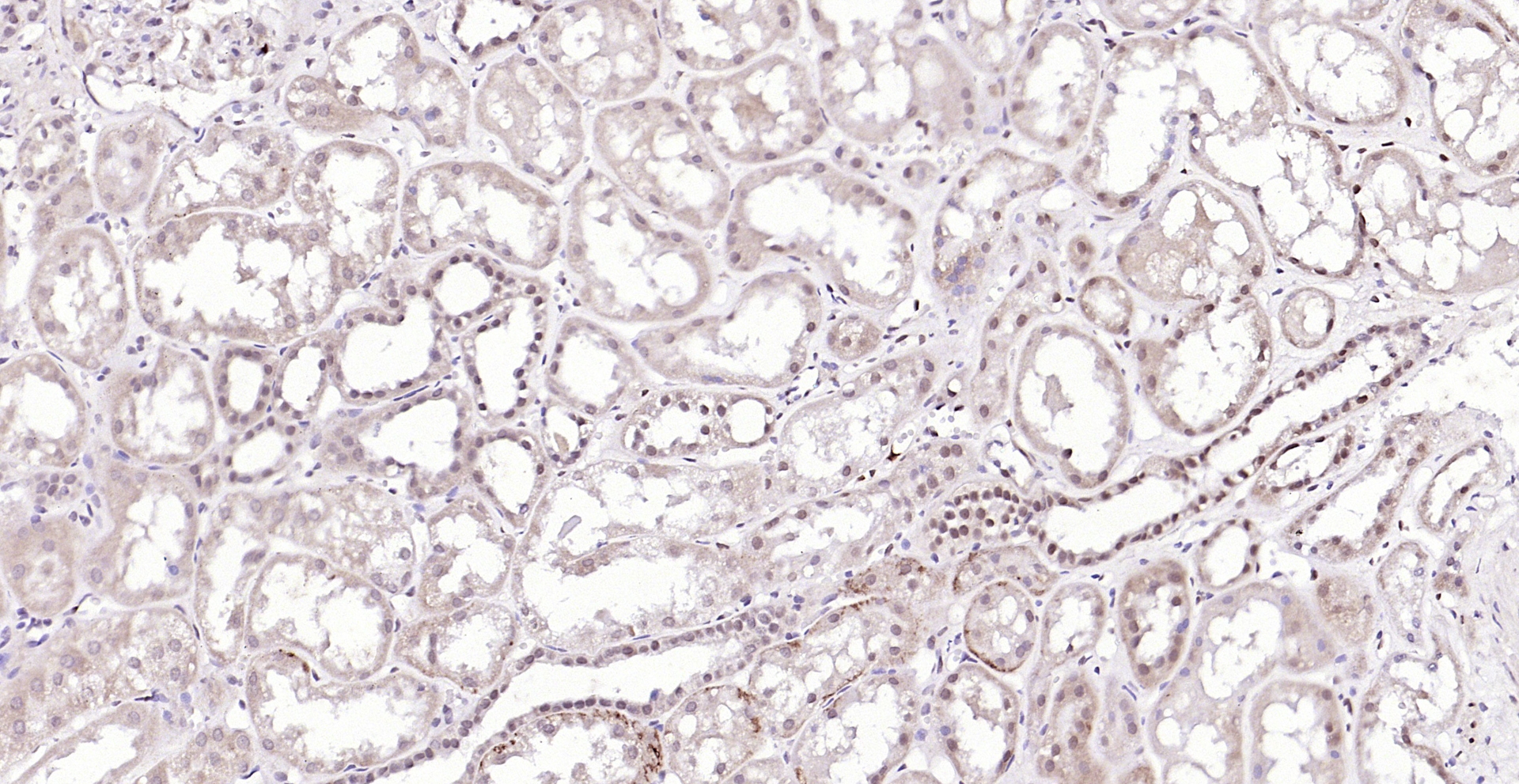 Paraformaldehyde-fixed, paraffin embedded (Human kidney); Antigen retrieval by boiling in sodium citrate buffer (pH6.0) for 15min; Block endogenous peroxidase by 3% hydrogen peroxide for 20 minutes; Blocking buffer (normal goat serum) at 37°C for 30min; Antibody incubation with (Caspase-6 subunit p11) Polyclonal Antibody, Unconjugated (bs-10135R) at 1:200 overnight at 4°C, followed by operating according to SP Kit(Rabbit) (sp-0023) instructionsand DAB staining.
