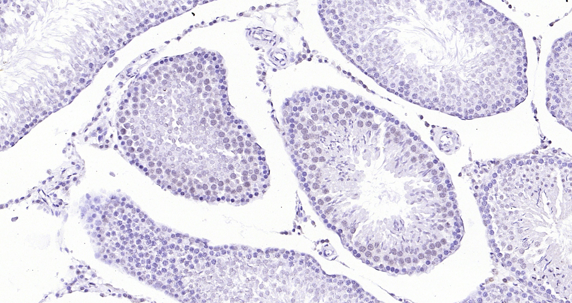 Paraformaldehyde-fixed, paraffin embedded (rat testis); Antigen retrieval by boiling in sodium citrate buffer (pH6.0) for 15min; Block endogenous peroxidase by 3% hydrogen peroxide for 20 minutes; Blocking buffer (normal goat serum) at 37°C for 30min; Antibody incubation with (BRCA2) Polyclonal Antibody, Unconjugated (bs-1210R) at 1:200 overnight at 4°C, followed by operating according to SP Kit(Rabbit) (sp-0023) instructionsand DAB staining.