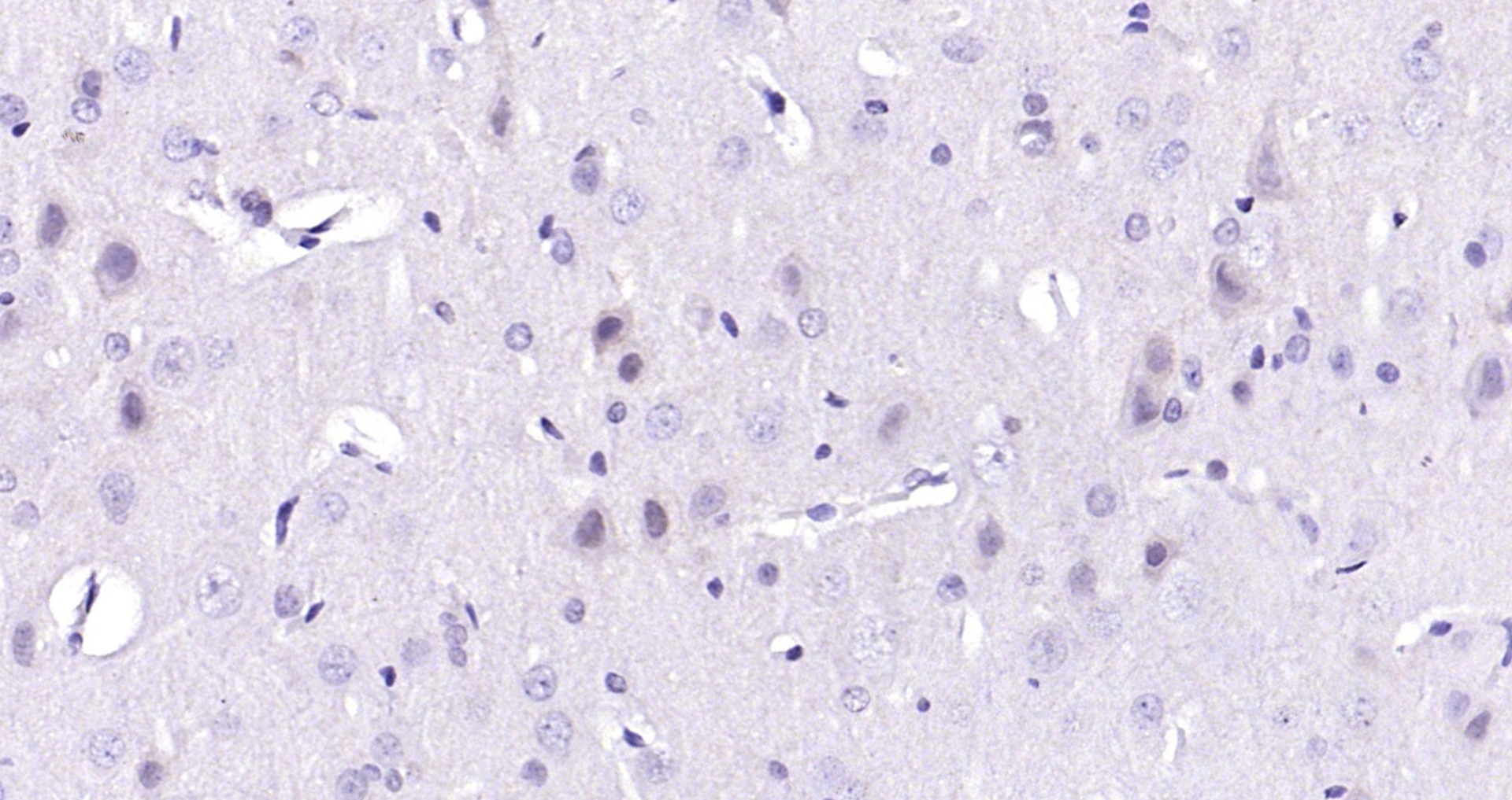 Paraformaldehyde-fixed, paraffin embedded (rat brain); Antigen retrieval by boiling in sodium citrate buffer (pH6.0) for 15min; Block endogenous peroxidase by 3% hydrogen peroxide for 20 minutes; Blocking buffer (normal goat serum) at 37°C for 30min; Antibody incubation with (BRCA2) Polyclonal Antibody, Unconjugated (bs-1210R) at 1:200 overnight at 4°C, followed by operating according to SP Kit(Rabbit) (sp-0023) instructionsand DAB staining.