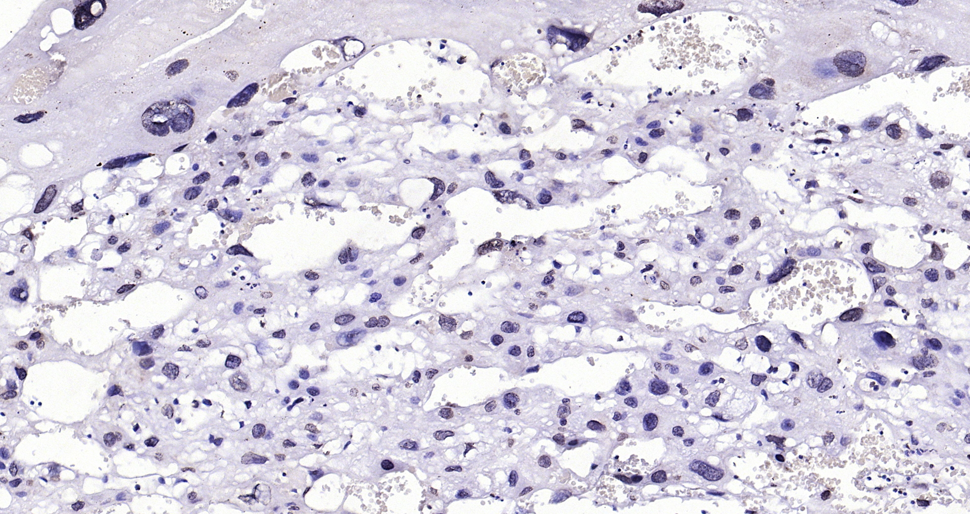 Paraformaldehyde-fixed, paraffin embedded (rat placenta); Antigen retrieval by boiling in sodium citrate buffer (pH6.0) for 15min; Block endogenous peroxidase by 3% hydrogen peroxide for 20 minutes; Blocking buffer (normal goat serum) at 37°C for 30min; Antibody incubation with (BRCA2) Polyclonal Antibody, Unconjugated (bs-1210R) at 1:200 overnight at 4°C, followed by operating according to SP Kit(Rabbit) (sp-0023) instructionsand DAB staining.