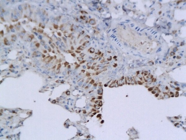 Formalin-fixed and paraffin embedded mouse lung labeled with Anti-CD57 Polyclonal Antibody, Unconjugated (bs-1635R) followed by conjugation to the secondary antibody and DAB staining