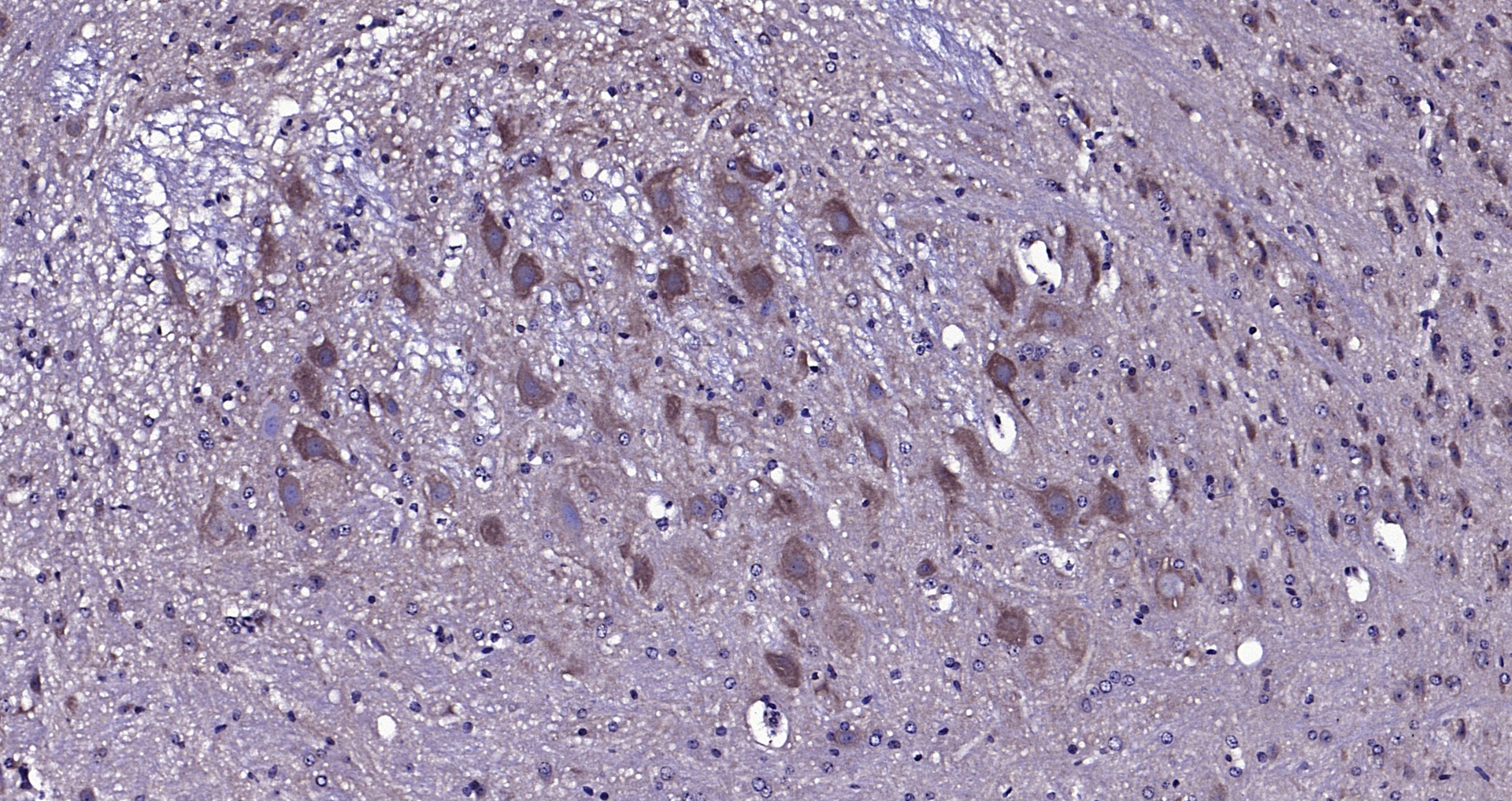Paraformaldehyde-fixed, paraffin embedded (Rat cerebellum); Antigen retrieval by boiling in sodium citrate buffer (pH6.0) for 15min; Block endogenous peroxidase by 3% hydrogen peroxide for 20 minutes; Blocking buffer (normal goat serum) at 37°C for 30min; Antibody incubation with (CACNA1G) Polyclonal Antibody, Unconjugated (bs-2781R) at 1:200 overnight at 4°C, followed by operating according to SP Kit(Rabbit) (sp-0023) instructionsand DAB staining