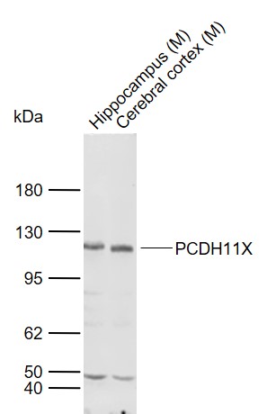 Lane 1: Mouse Hippocampus tissue lysates; Lane 2: Mouse Cerebral cortex tissue lysates probed with PCDH11X Polyclonal Antibody, Unconjugated (bs-11107R) at 1:1000 dilution and 4°C overnight incubation. Followed by conjugated secondary antibody incubation at 1:20000 for 60 min at 37˚C.