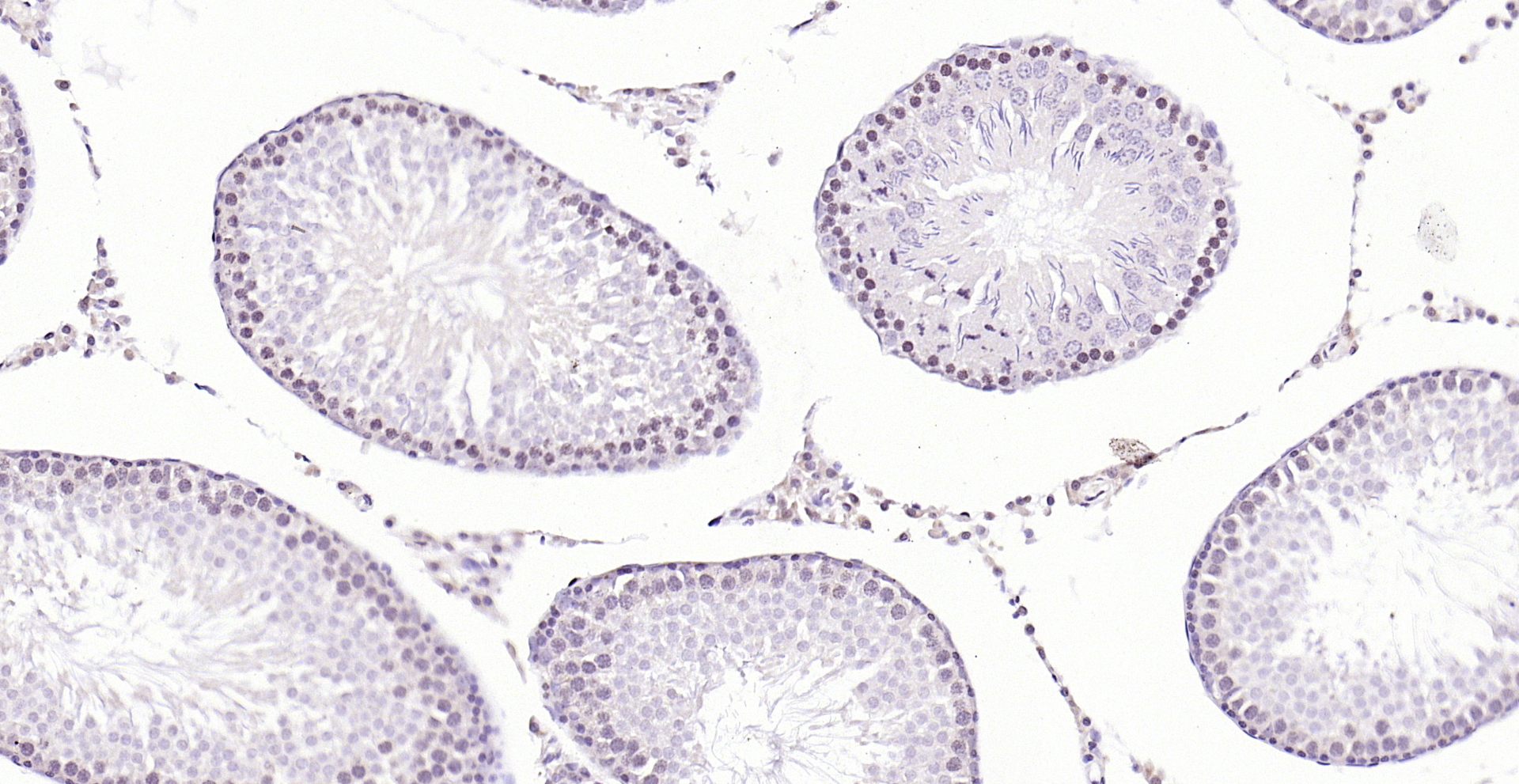 Paraformaldehyde-fixed, paraffin embedded (rat testis); Antigen retrieval by boiling in sodium citrate buffer (pH6.0) for 15min; Block endogenous peroxidase by 3% hydrogen peroxide for 20 minutes; Blocking buffer (normal goat serum) at 37°C for 30min; Antibody incubation with (CDK6) Polyclonal Antibody, Unconjugated (bs-0568R) at 1:200 overnight at 4°C, followed by operating according to SP Kit(Rabbit) (sp-0023) instructionsand DAB staining.