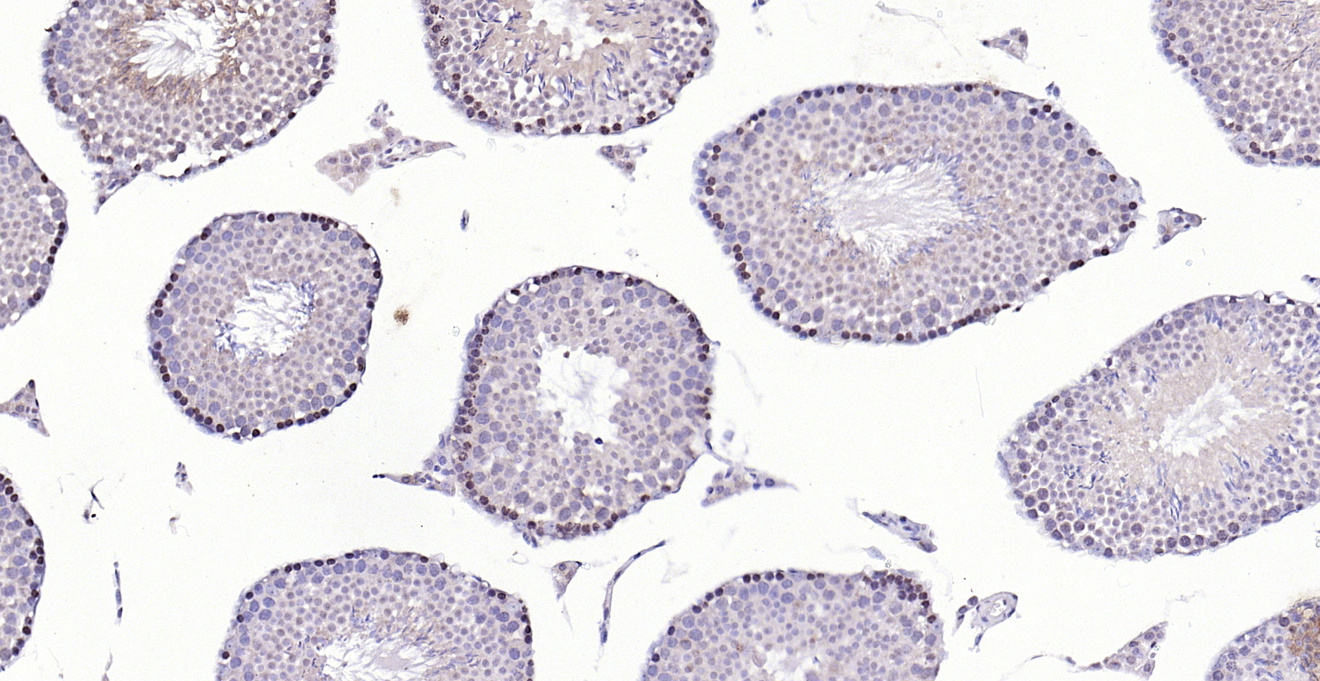 Paraformaldehyde-fixed, paraffin embedded (mouse testis); Antigen retrieval by boiling in sodium citrate buffer (pH6.0) for 15min; Block endogenous peroxidase by 3% hydrogen peroxide for 20 minutes; Blocking buffer (normal goat serum) at 37°C for 30min; Antibody incubation with (CDK6) Polyclonal Antibody, Unconjugated (bs-0568R) at 1:200 overnight at 4°C, followed by operating according to SP Kit(Rabbit) (sp-0023) instructionsand DAB staining.