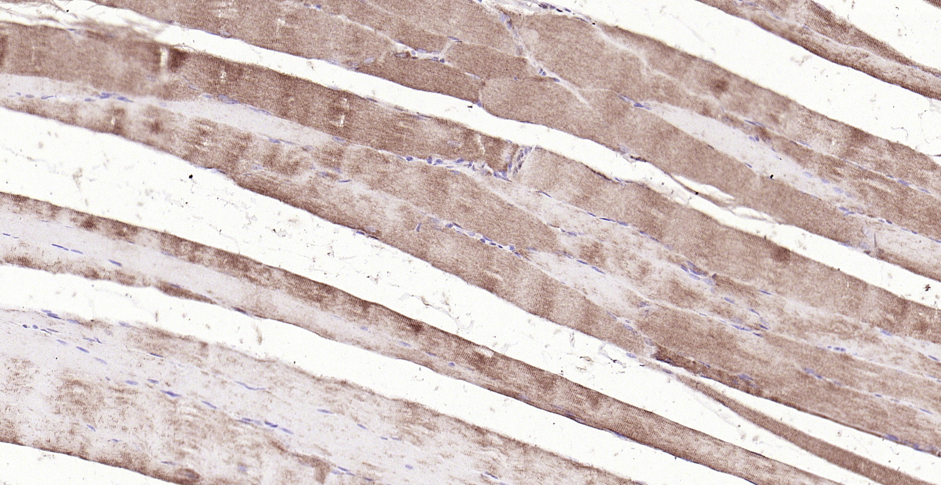 Paraformaldehyde-fixed, paraffin embedded (rat skeletal muscle); Antigen retrieval by boiling in sodium citrate buffer (pH6.0) for 15min; Block endogenous peroxidase by 3% hydrogen peroxide for 20 minutes; Blocking buffer (normal goat serum) at 37°C for 30min; Antibody incubation with (MAPKAP Kinase 2) Polyclonal Antibody, Unconjugated (bs-2908R) at 1:200 overnight at 4°C, followed by operating according to SP Kit(Rabbit) (sp-0023) instructionsand DAB staining.
