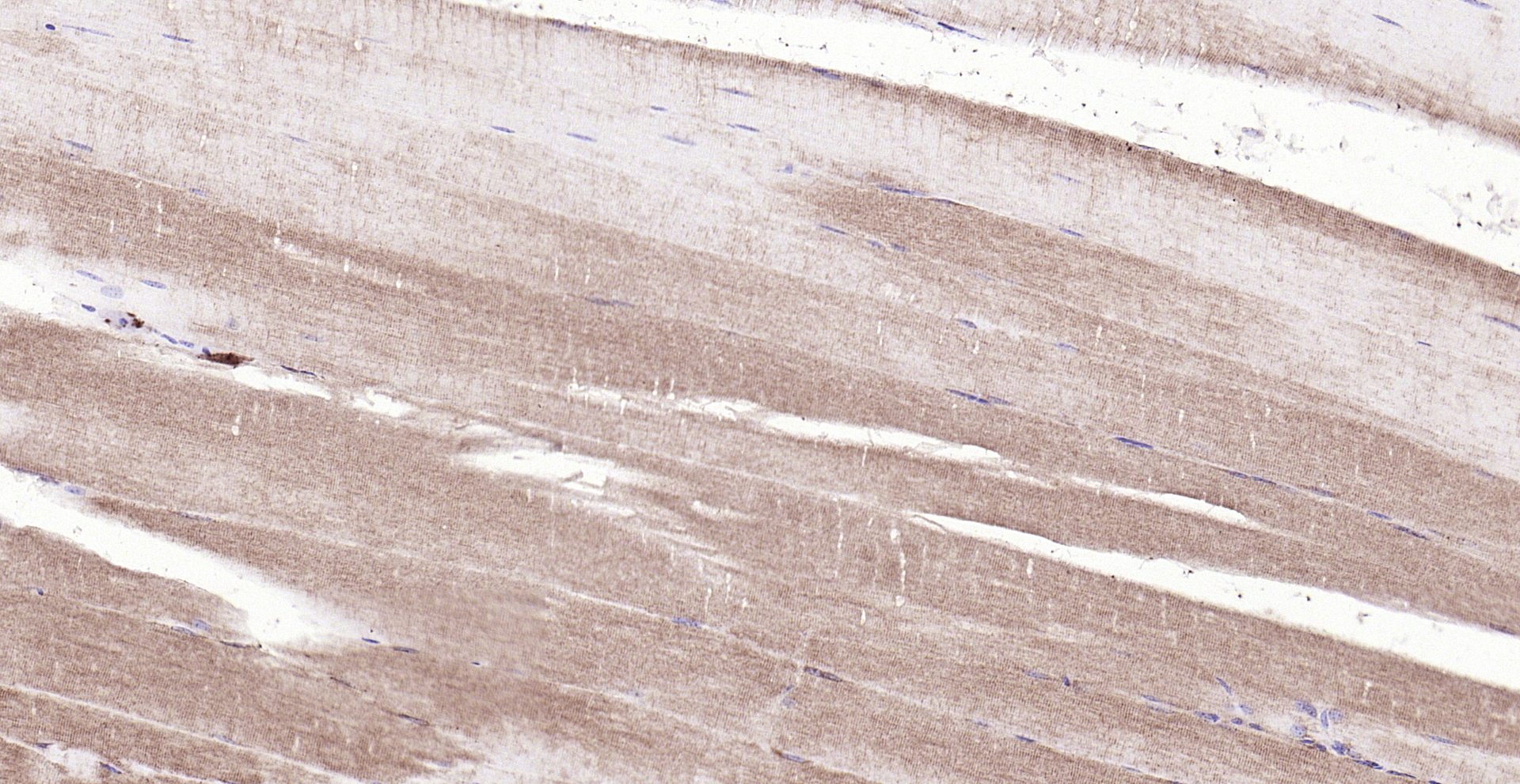 Paraformaldehyde-fixed, paraffin embedded (mouse skeletal muscle); Antigen retrieval by boiling in sodium citrate buffer (pH6.0) for 15min; Block endogenous peroxidase by 3% hydrogen peroxide for 20 minutes; Blocking buffer (normal goat serum) at 37°C for 30min; Antibody incubation with (MAPKAP Kinase 2) Polyclonal Antibody, Unconjugated (bs-2908R) at 1:200 overnight at 4°C, followed by operating according to SP Kit(Rabbit) (sp-0023) instructionsand DAB staining.