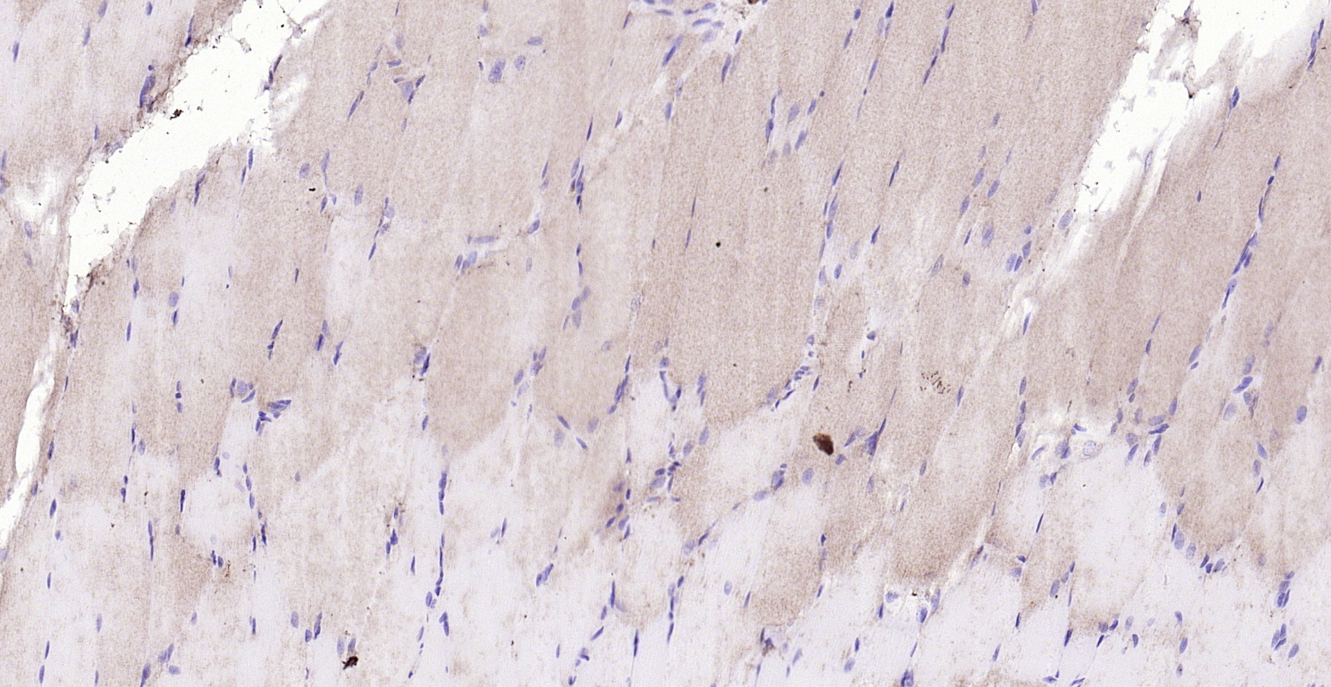Paraformaldehyde-fixed, paraffin embedded (rat skeletal muscle); Antigen retrieval by boiling in sodium citrate buffer (pH6.0) for 15min; Block endogenous peroxidase by 3% hydrogen peroxide for 20 minutes; Blocking buffer (normal goat serum) at 37°C for 30min; Antibody incubation with (HOMER2) Polyclonal Antibody, Unconjugated (bs-4632R) at 1:200 overnight at 4°C, followed by operating according to SP Kit(Rabbit) (sp-0023) instructionsand DAB staining.