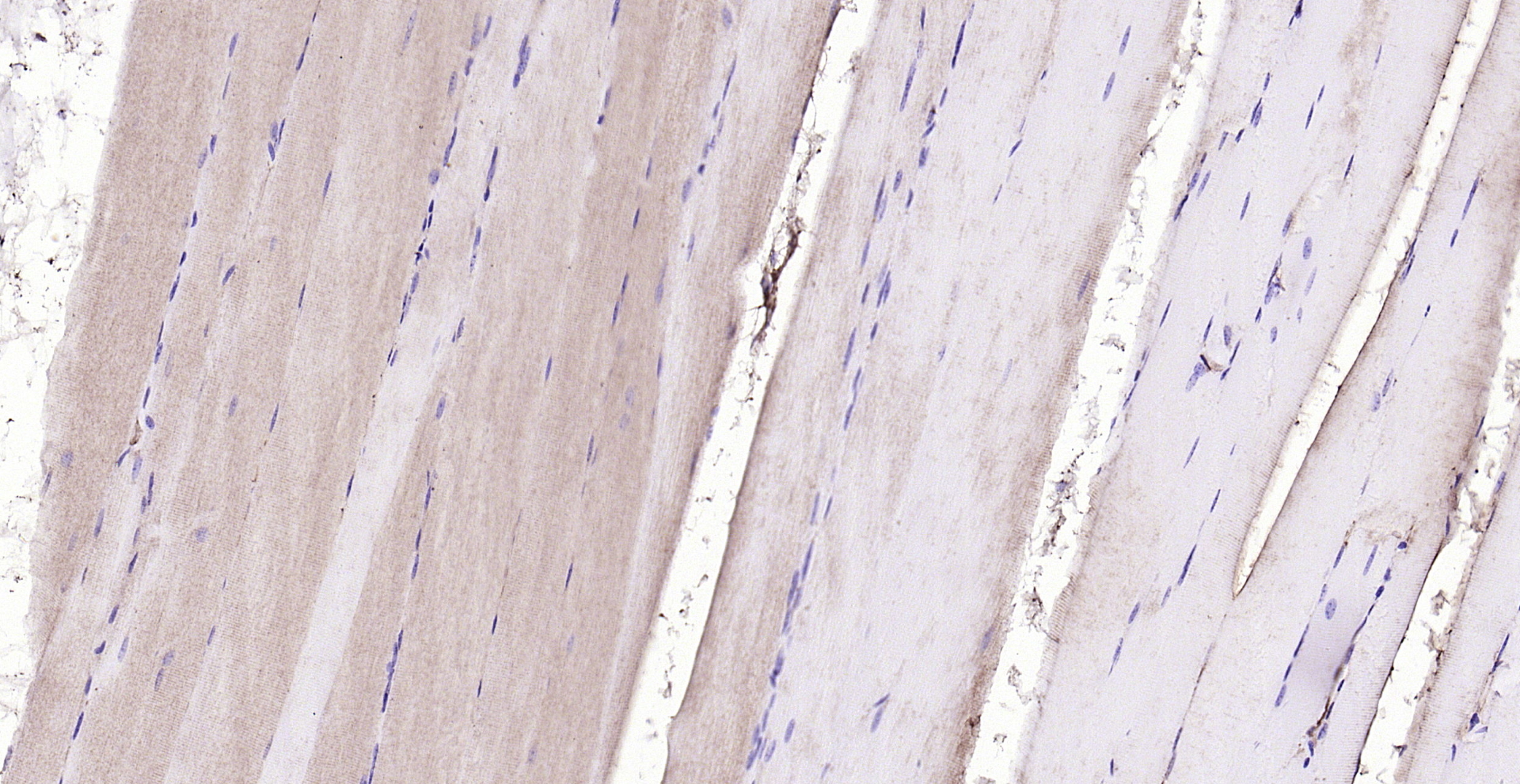 Paraformaldehyde-fixed, paraffin embedded (mouse skeletal muscle); Antigen retrieval by boiling in sodium citrate buffer (pH6.0) for 15min; Block endogenous peroxidase by 3% hydrogen peroxide for 20 minutes; Blocking buffer (normal goat serum) at 37°C for 30min; Antibody incubation with (HOMER2) Polyclonal Antibody, Unconjugated (bs-4632R) at 1:200 overnight at 4°C, followed by operating according to SP Kit(Rabbit) (sp-0023) instructionsand DAB staining. Paraformaldehyde-fixed, paraffin embedded (mouse skeletal muscle); Antigen retrieval by boiling in sodium citrate buffer (pH6.0) for 15min; Block endogenous peroxidase by 3% hydrogen peroxide for 20 minutes; Blocking buffer (normal goat serum) at 37°C for 30min; Antibody incubation with (HOMER2) Polyclonal Antibody, Unconjugated (bs-4632R) at 1:200 overnight at 4°C, followed by operating according to SP Kit(Rabbit) (sp-0023) instructionsand DAB staining.