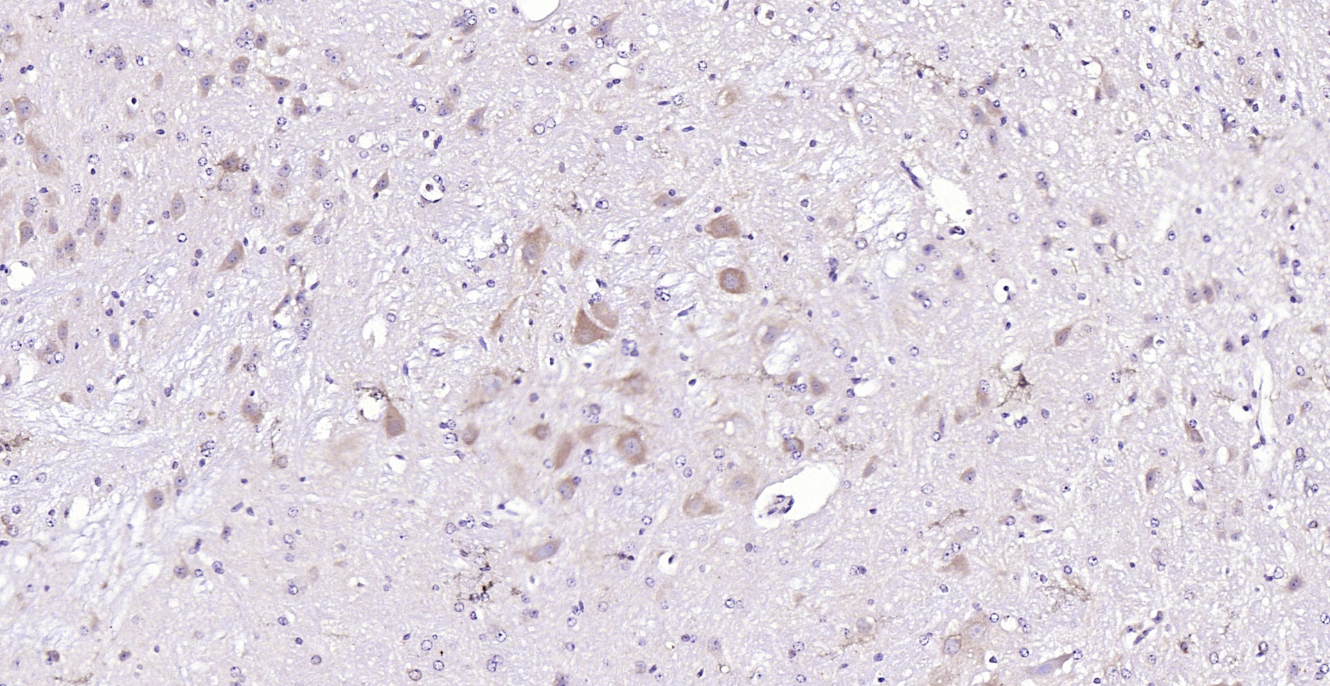 Paraformaldehyde-fixed, paraffin embedded (mouse cerebellum); Antigen retrieval by boiling in sodium citrate buffer (pH6.0) for 15min; Block endogenous peroxidase by 3% hydrogen peroxide for 20 minutes; Blocking buffer (normal goat serum) at 37°C for 30min; Antibody incubation with (NUAK2) Polyclonal Antibody, Unconjugated (bs-5811R) at 1:200 overnight at 4°C, followed by operating according to SP Kit(Rabbit) (sp-0023) instructionsand DAB staining.