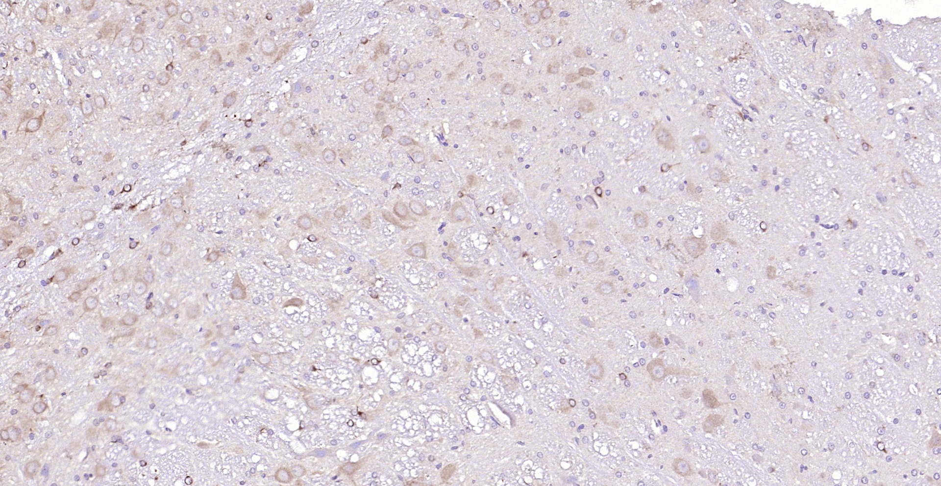 Paraformaldehyde-fixed, paraffin embedded (rat cerebellum); Antigen retrieval by boiling in sodium citrate buffer (pH6.0) for 15min; Block endogenous peroxidase by 3% hydrogen peroxide for 20 minutes; Blocking buffer (normal goat serum) at 37°C for 30min; Antibody incubation with (NUAK2) Polyclonal Antibody, Unconjugated (bs-5811R) at 1:200 overnight at 4°C, followed by operating according to SP Kit(Rabbit) (sp-0023) instructionsand DAB staining.