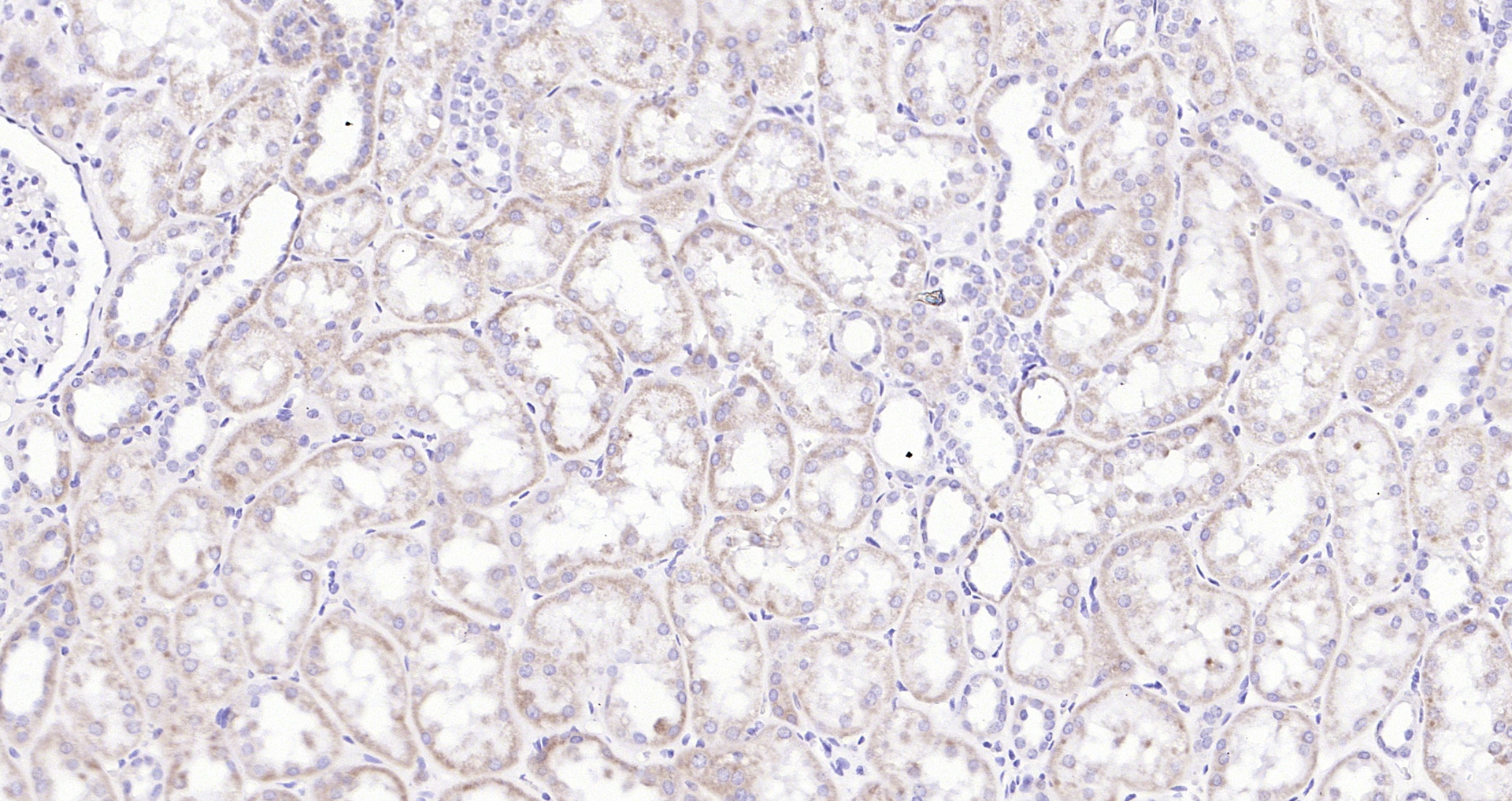 Paraformaldehyde-fixed, paraffin embedded (Human kidney); Antigen retrieval by boiling in sodium citrate buffer (pH6.0) for 15min; Block endogenous peroxidase by 3% hydrogen peroxide for 20 minutes; Blocking buffer (normal goat serum) at 37°C for 30min; Antibody incubation with (Cyr61) Polyclonal Antibody, Unconjugated (bs-1290R) at 1:200 overnight at 4°C, followed by operating according to SP Kit(Rabbit) (sp-0023) instructionsand DAB staining.