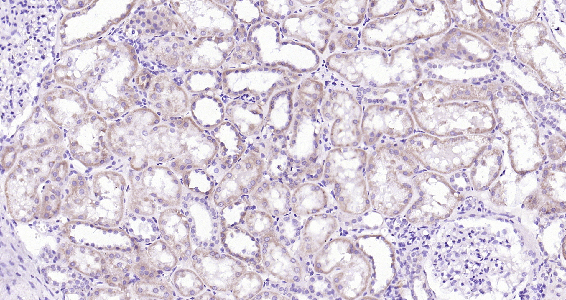 Paraformaldehyde-fixed, paraffin embedded (Human kidney); Antigen retrieval by boiling in sodium citrate buffer (pH6.0) for 15min; Block endogenous peroxidase by 3% hydrogen peroxide for 20 minutes; Blocking buffer (normal goat serum) at 37°C for 30min; Antibody incubation with (eRF1) Polyclonal Antibody, Unconjugated (bs-13098R) at 1:200 overnight at 4°C, followed by operating according to SP Kit(Rabbit) (sp-0023) instructionsand DAB staining.