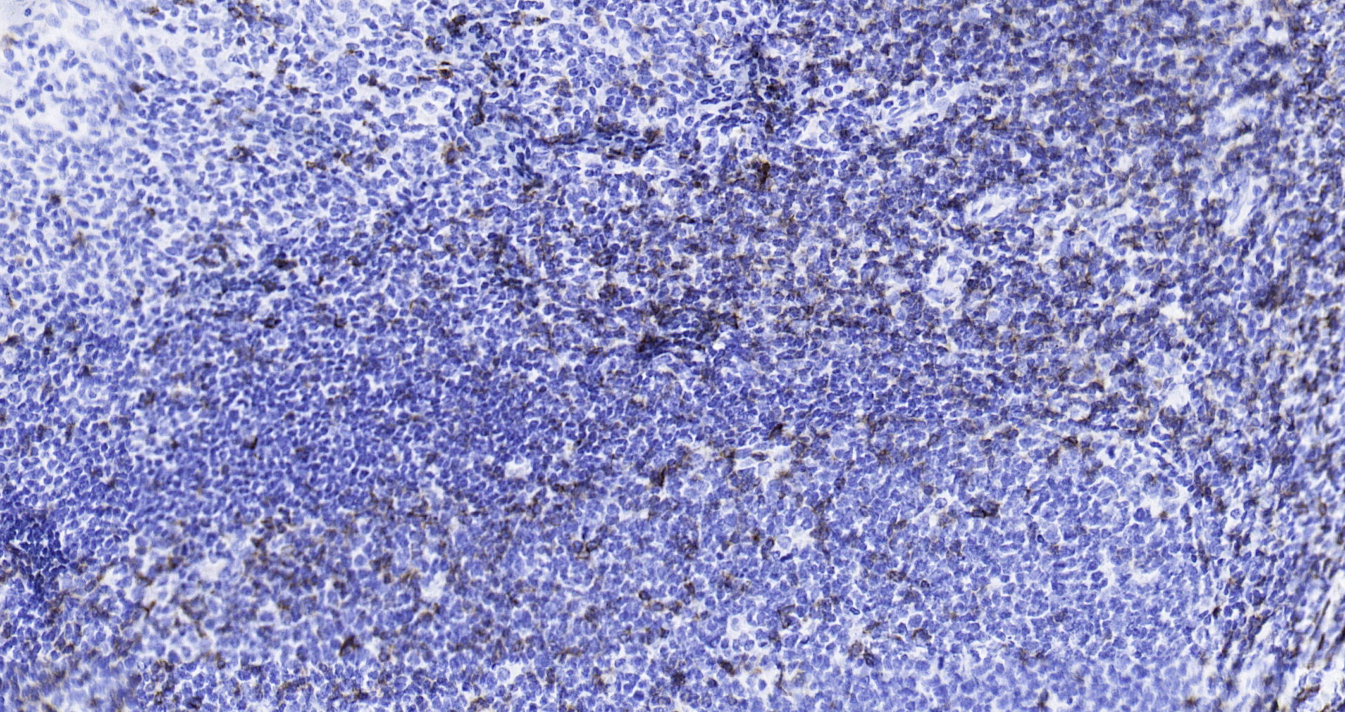 Paraformaldehyde-fixed, paraffin embedded (human tonsil); Antigen retrieval by boiling in sodium citrate buffer (pH6.0) for 15min; Block endogenous peroxidase by 3% hydrogen peroxide for 20 minutes; Blocking buffer (normal goat serum) at 37°C for 30min; Antibody incubation with (CD3 epsilon (7A4)) Monoclonal Antibody, Unconjugated (bsm-52386R) at 1:200 overnight at 4°C, followed by operating according to SP Kit(Rabbit) (sp-0023) instructionsand DAB staining. Paraformaldehyde-fixed, paraffin embedded (human tonsil); Antigen retrieval by boiling in sodium citrate buffer (pH6.0) for 15min; Block endogenous peroxidase by 3% hydrogen peroxide for 20 minutes; Blocking buffer (normal goat serum) at 37°C for 30min; Antibody incubation with (CD3 epsilon (7A4)) Monoclonal Antibody, Unconjugated (bsm-52386R) at 1:200 overnight at 4°C, followed by operating according to SP Kit(Rabbit) (sp-0023) instructionsand DAB staining.