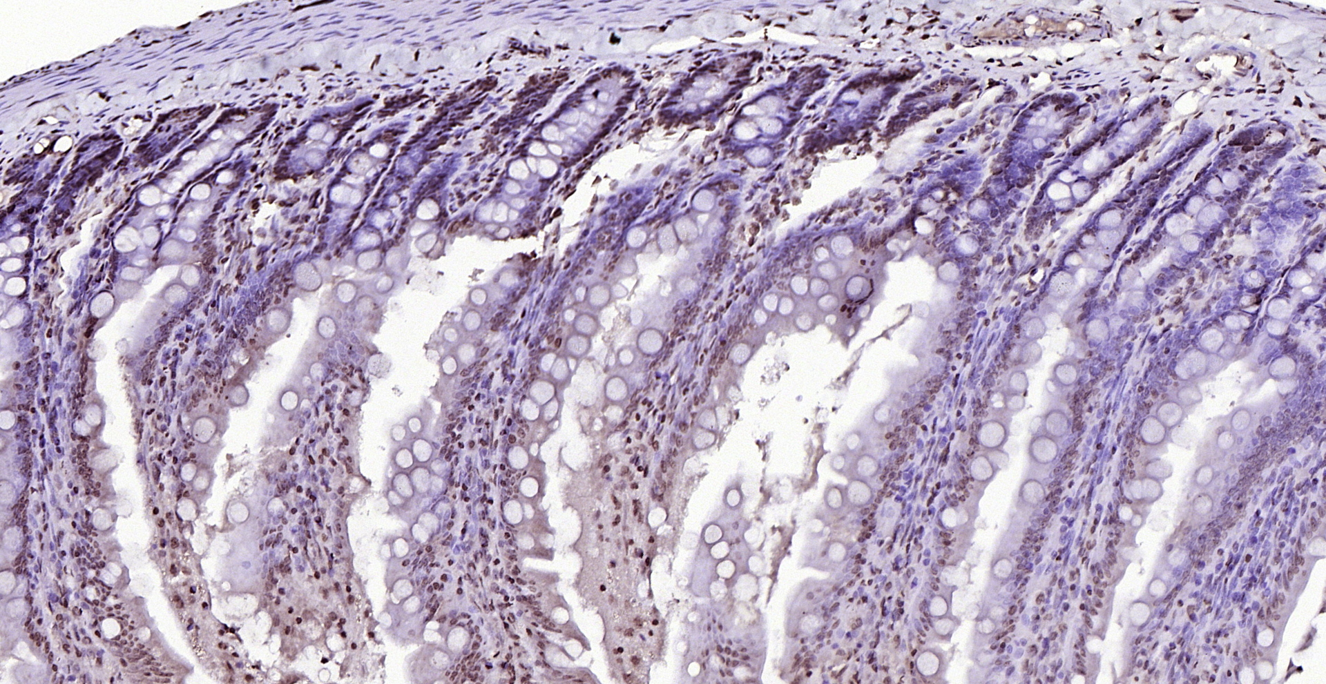 Paraformaldehyde-fixed, paraffin embedded (rat small intestine); Antigen retrieval by boiling in sodium citrate buffer (pH6.0) for 15min; Block endogenous peroxidase by 3% hydrogen peroxide for 20 minutes; Blocking buffer (normal goat serum) at 37°C for 30min; Antibody incubation with (AMIGO2) Polyclonal Antibody, Unconjugated (bs-11450R) at 1:200 overnight at 4°C, followed by operating according to SP Kit(Rabbit) (sp-0023) instructionsand DAB staining. Paraformaldehyde-fixed, paraffin embedded (rat small intestine); Antigen retrieval by boiling in sodium citrate buffer (pH6.0) for 15min; Block endogenous peroxidase by 3% hydrogen peroxide for 20 minutes; Blocking buffer (normal goat serum) at 37°C for 30min; Antibody incubation with (AMIGO2) Polyclonal Antibody, Unconjugated (bs-11450R) at 1:200 overnight at 4°C, followed by operating according to SP Kit(Rabbit) (sp-0023) instructionsand DAB staining.