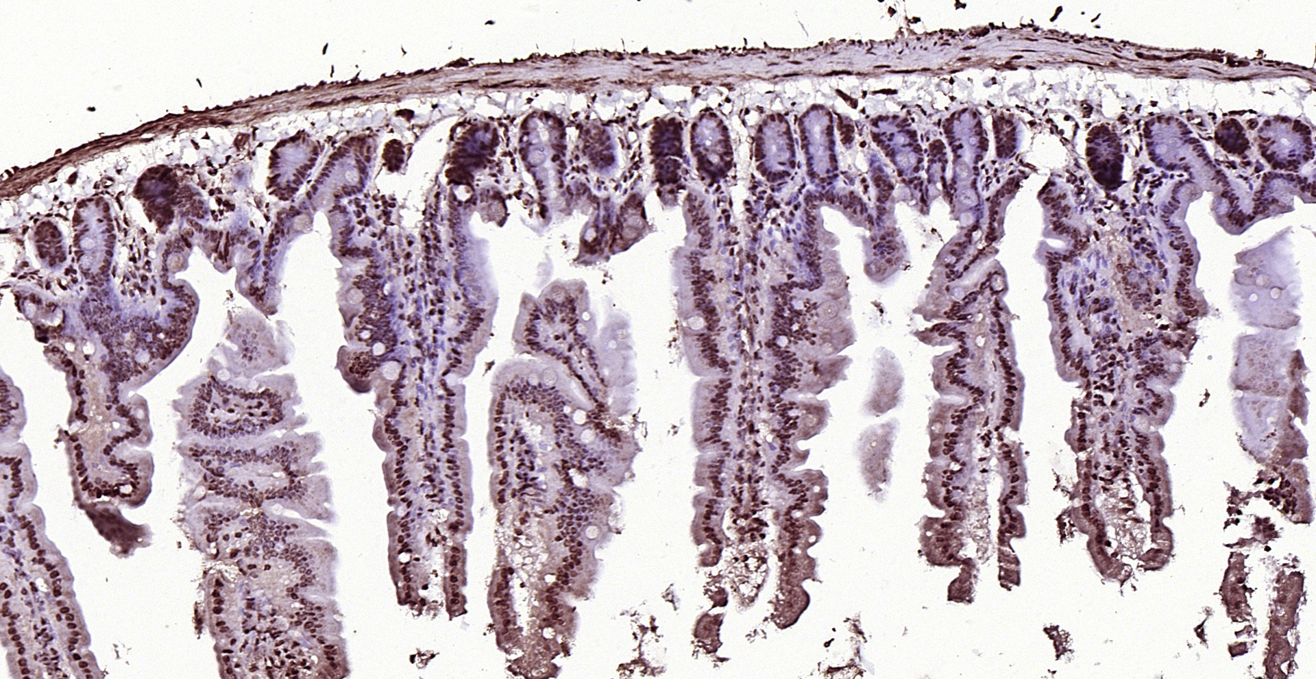 Paraformaldehyde-fixed, paraffin embedded (mouse small intestine); Antigen retrieval by boiling in sodium citrate buffer (pH6.0) for 15min; Block endogenous peroxidase by 3% hydrogen peroxide for 20 minutes; Blocking buffer (normal goat serum) at 37°C for 30min; Antibody incubation with (AMIGO2) Polyclonal Antibody, Unconjugated (bs-11450R) at 1:200 overnight at 4°C, followed by operating according to SP Kit(Rabbit) (sp-0023) instructionsand DAB staining. Paraformaldehyde-fixed, paraffin embedded (mouse small intestine); Antigen retrieval by boiling in sodium citrate buffer (pH6.0) for 15min; Block endogenous peroxidase by 3% hydrogen peroxide for 20 minutes; Blocking buffer (normal goat serum) at 37°C for 30min; Antibody incubation with (AMIGO2) Polyclonal Antibody, Unconjugated (bs-11450R) at 1:200 overnight at 4°C, followed by operating according to SP Kit(Rabbit) (sp-0023) instructionsand DAB staining.