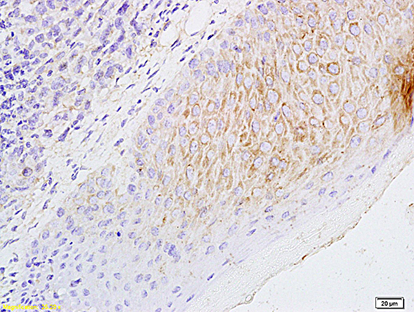 Formalin-fixed and paraffin embedded mouse foot tumor labeled with Anti-CCL21/6CKINE Polyclonal Antibody, Unconjugated (bs-1666R) followed by conjugation to the secondary antibody and DAB staining
