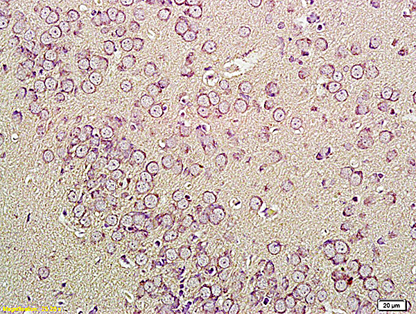 Formalin-fixed and paraffin embedded human cervical tissue labeled with Anti-CNR1 Polyclonal Antibody, Unconjugated (bs-1683R) at 1:200, followed by conjugation to the secondary antibody and DAB staining